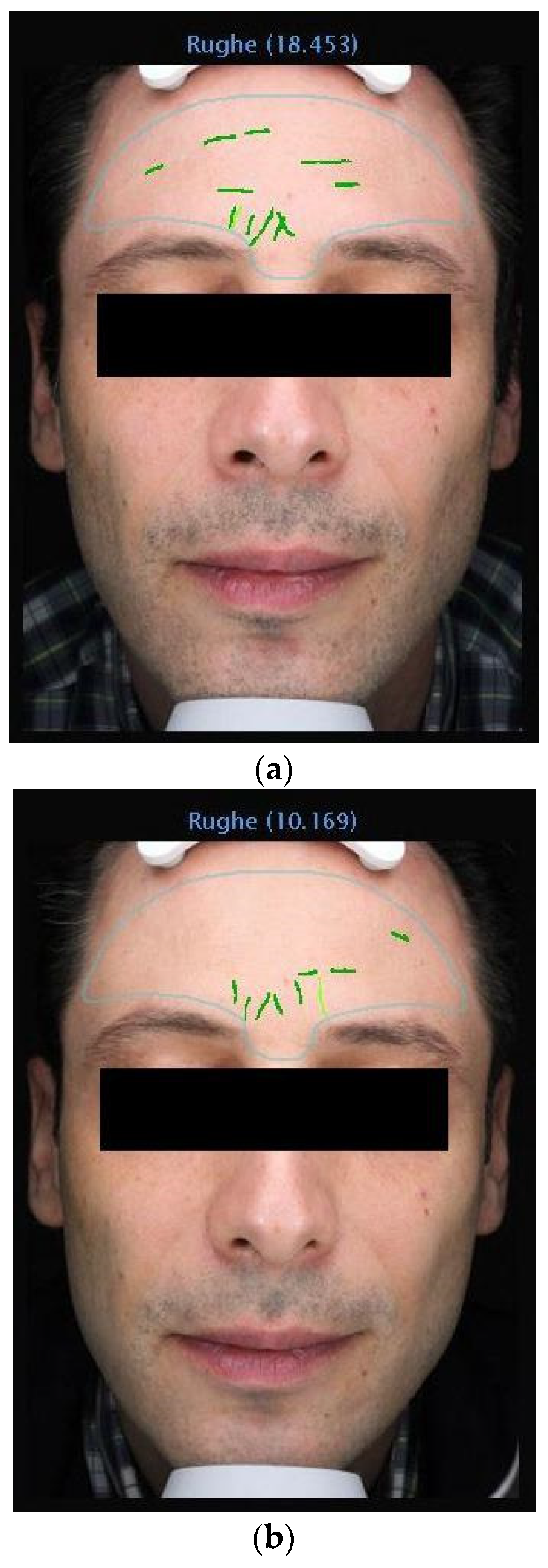 Medicina 60 00947 g003