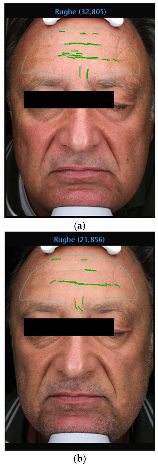 Medicina 60 00947 g004