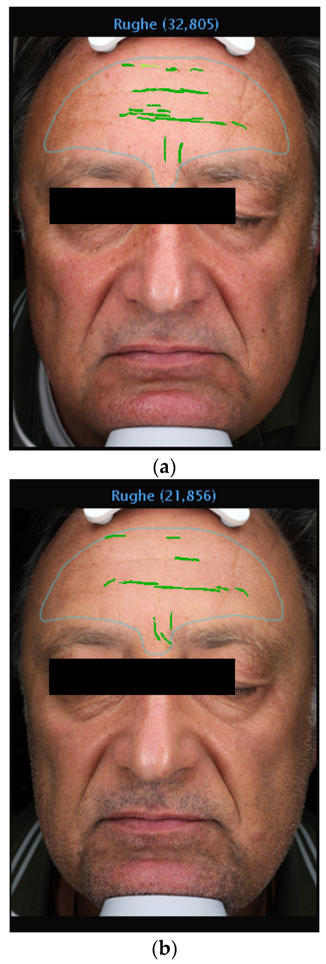 Medicina 60 00947 g004