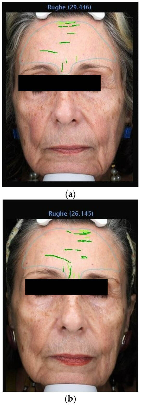 Medicina 60 00947 g005