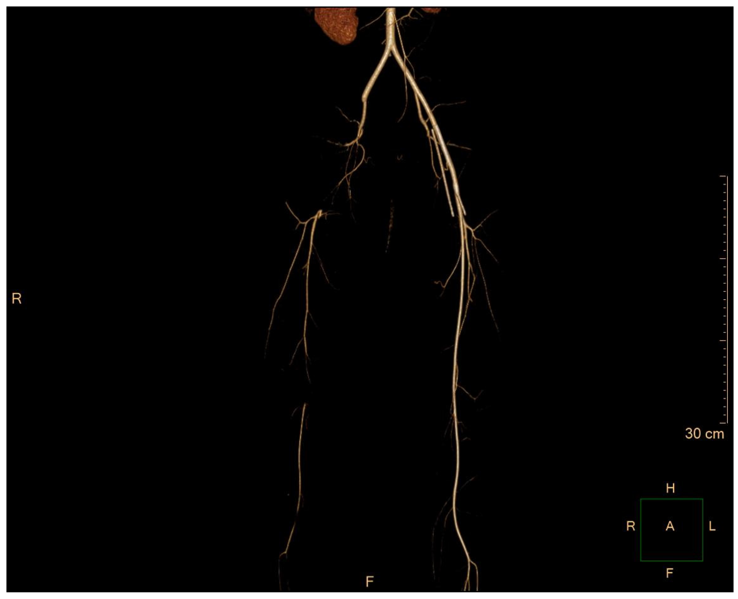 Medicina 60 00969 g001