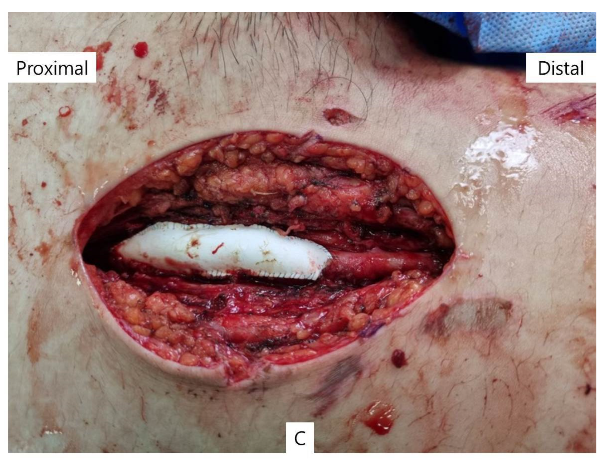 Medicina 60 00969 g002b