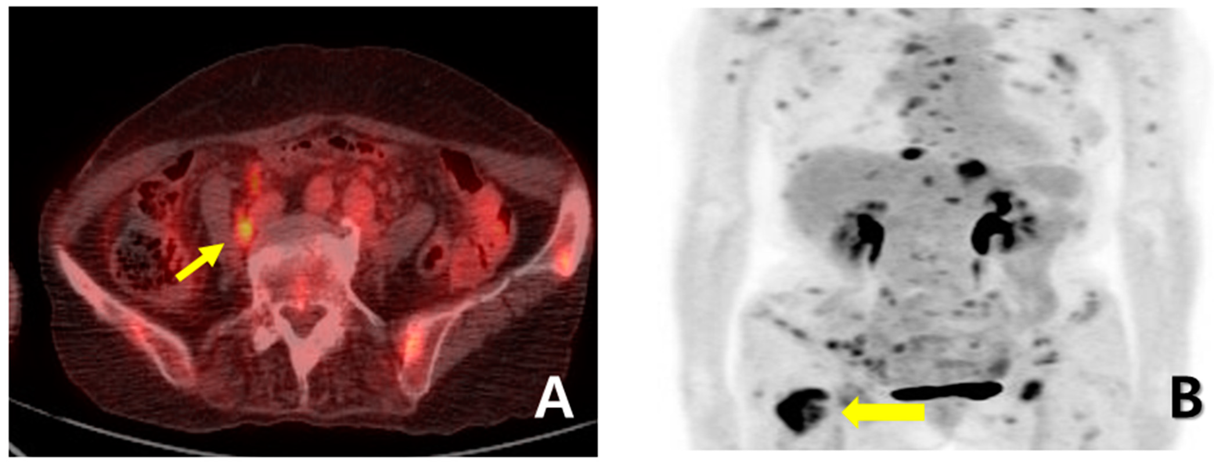 Medicina 60 00980 g004