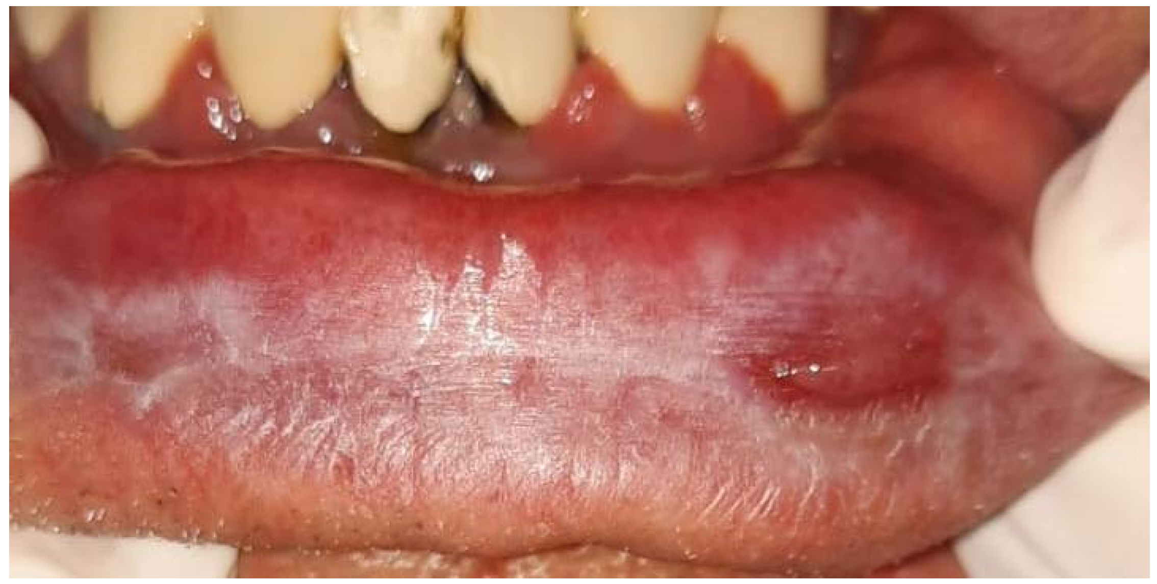 Medicina 60 00987 g002