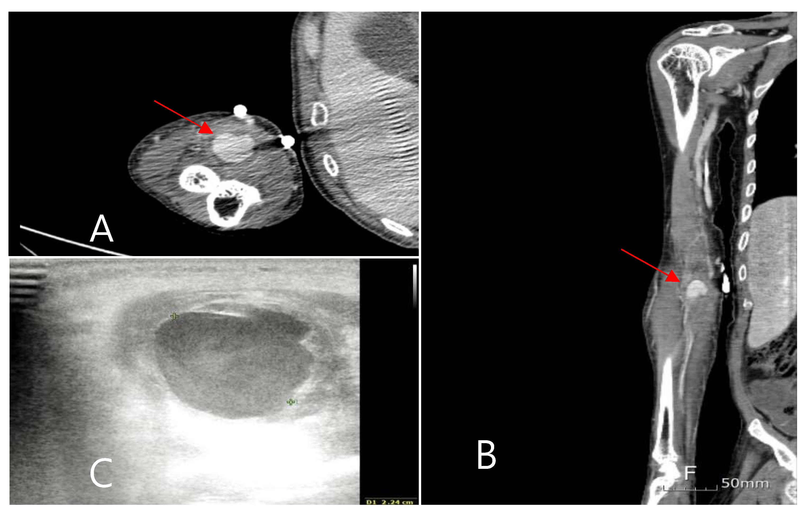 Medicina 60 01007 g001