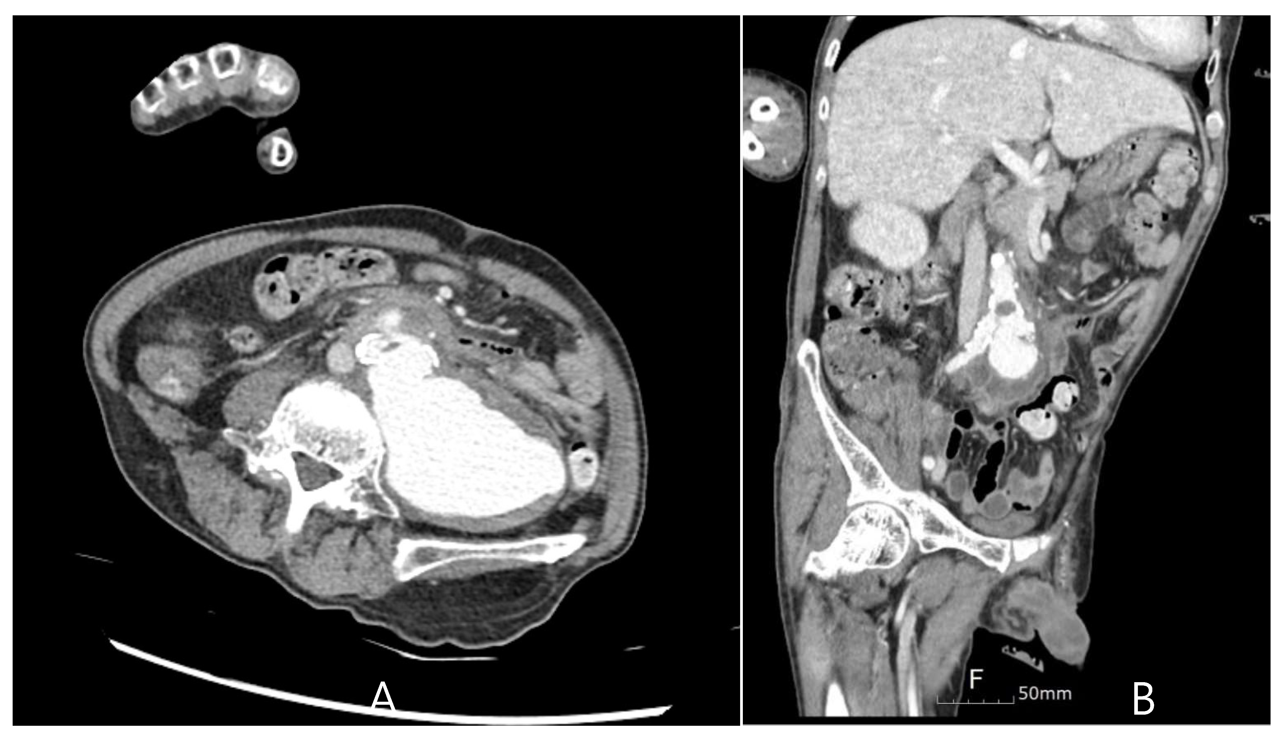 Medicina 60 01007 g003