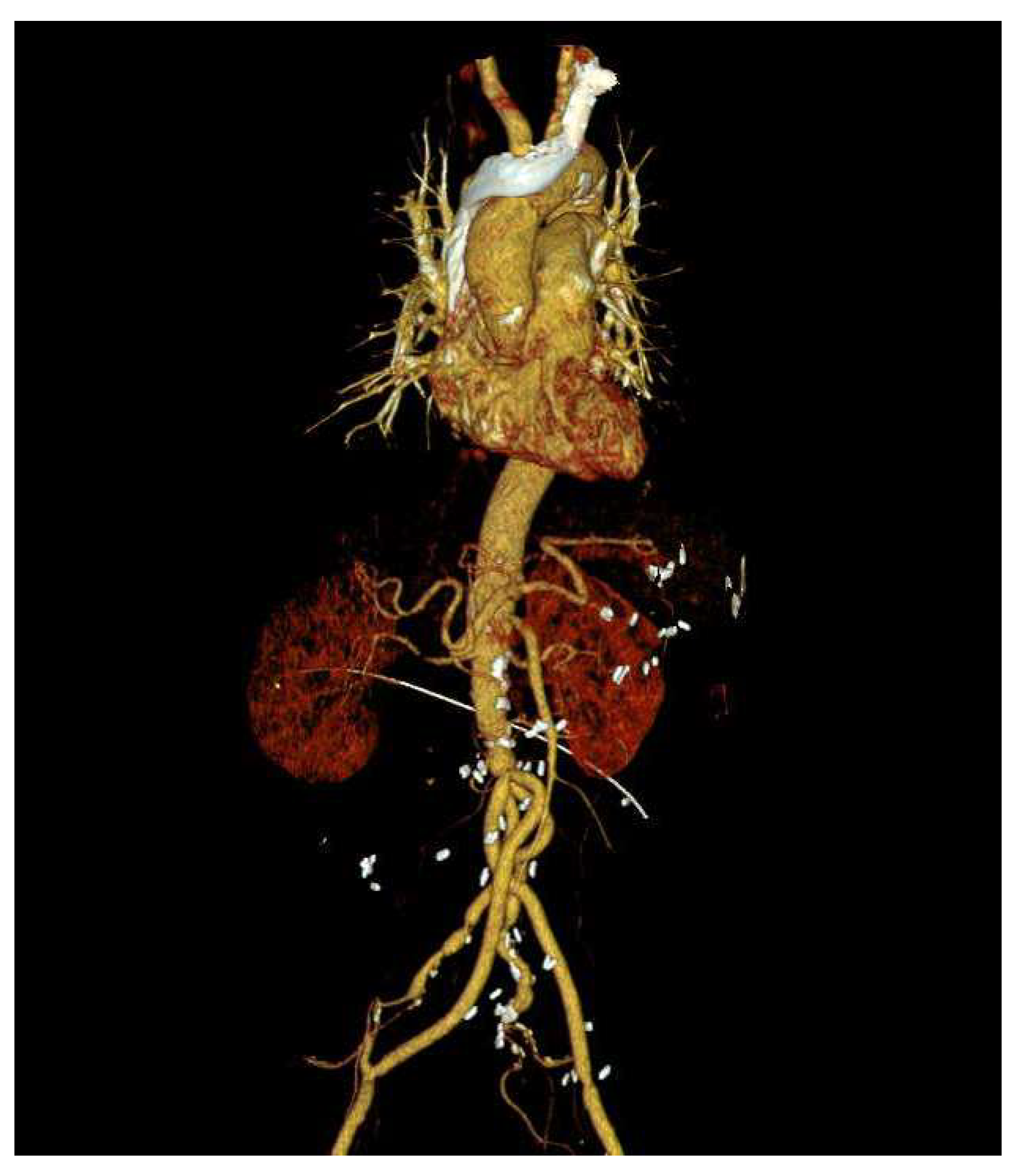 Medicina 60 01007 g004