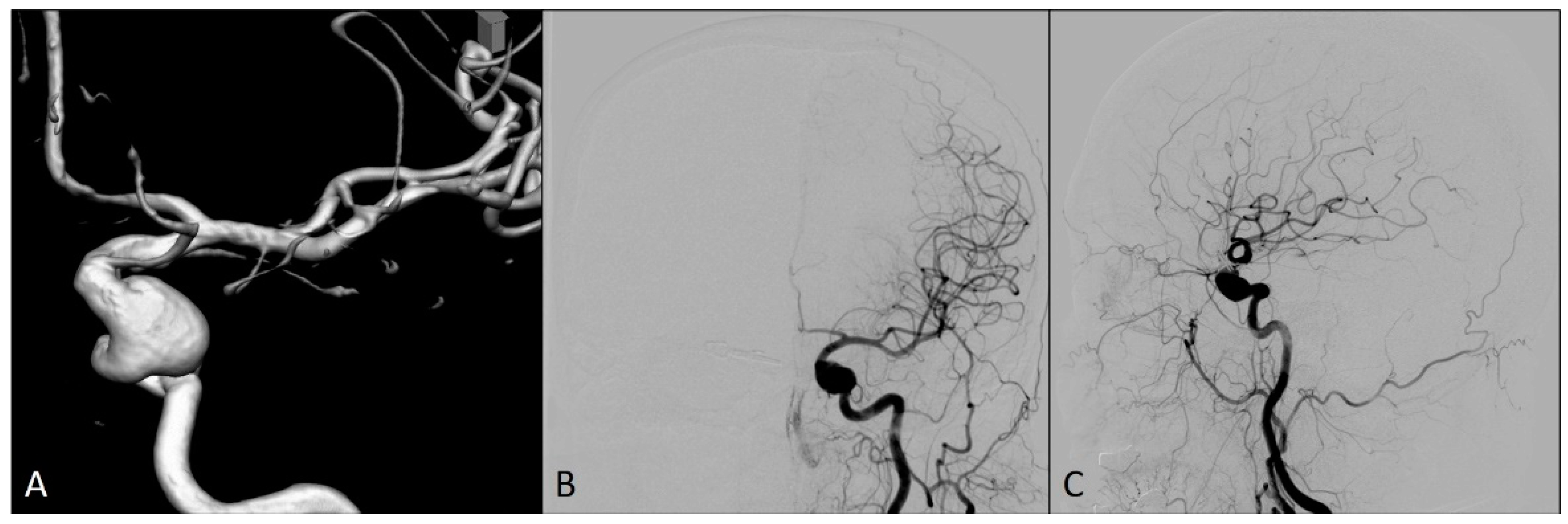 Medicina 60 01034 g001
