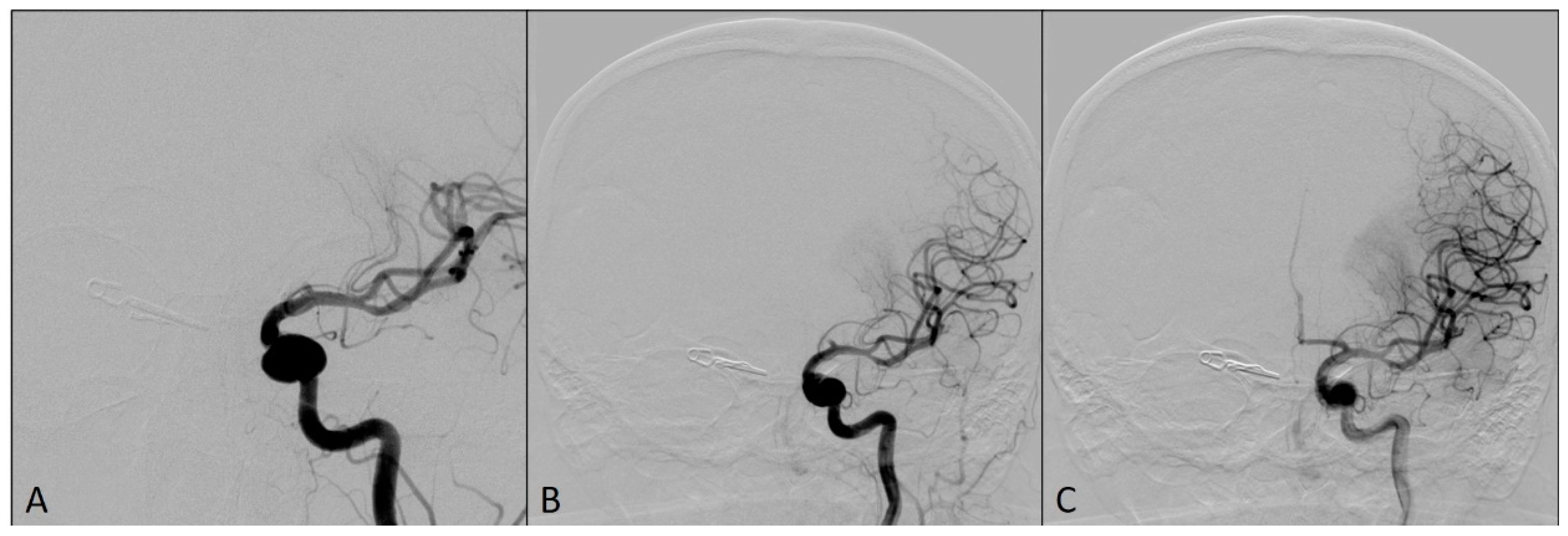 Medicina 60 01034 g003