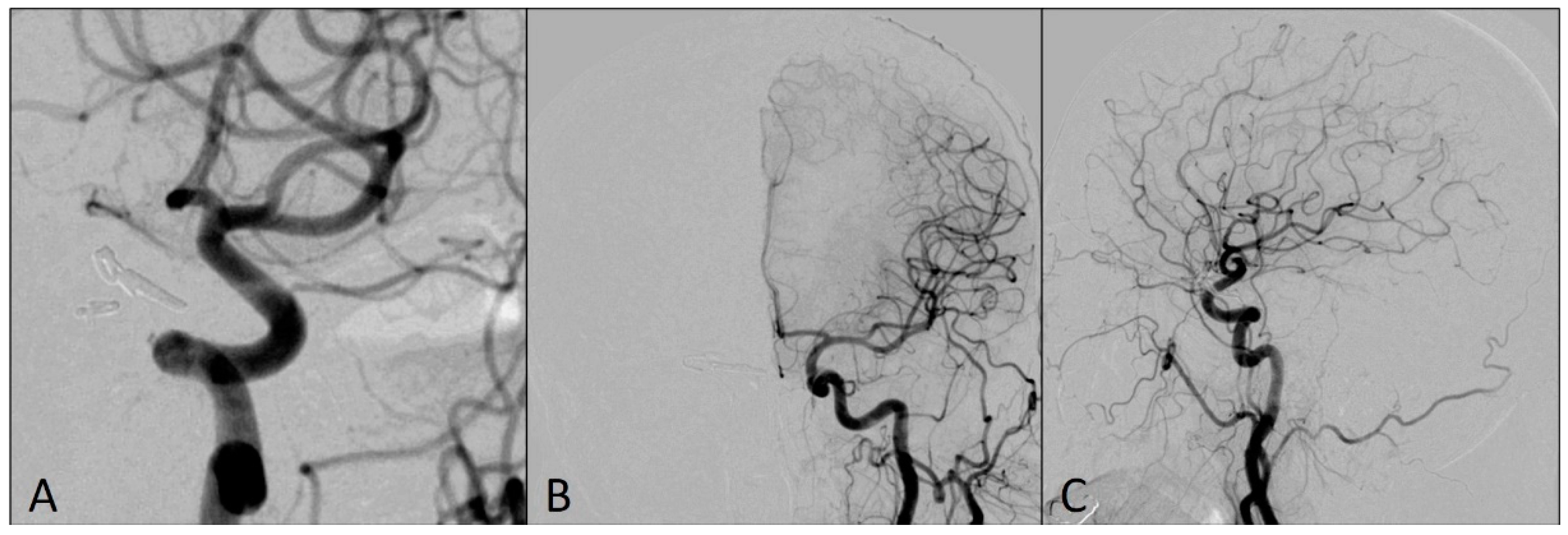 Medicina 60 01034 g005