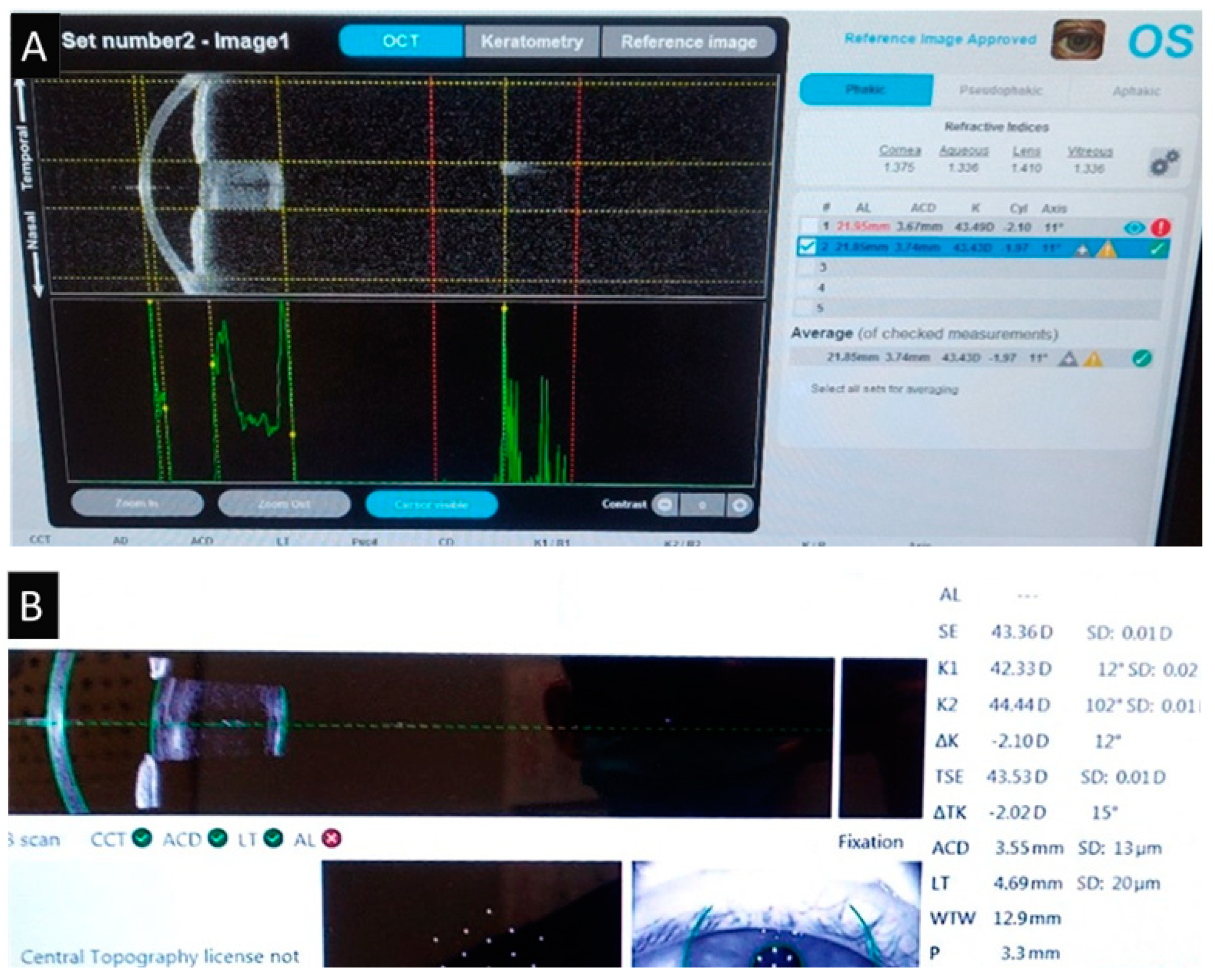 Medicina 60 01057 g006