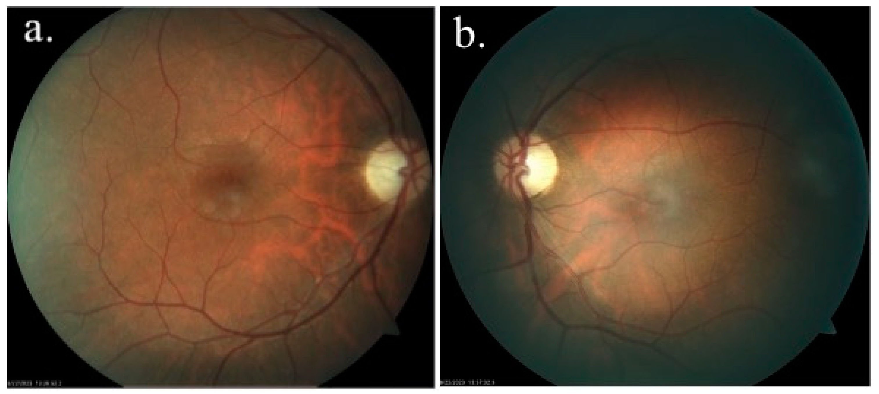 Medicina 60 01064 g001