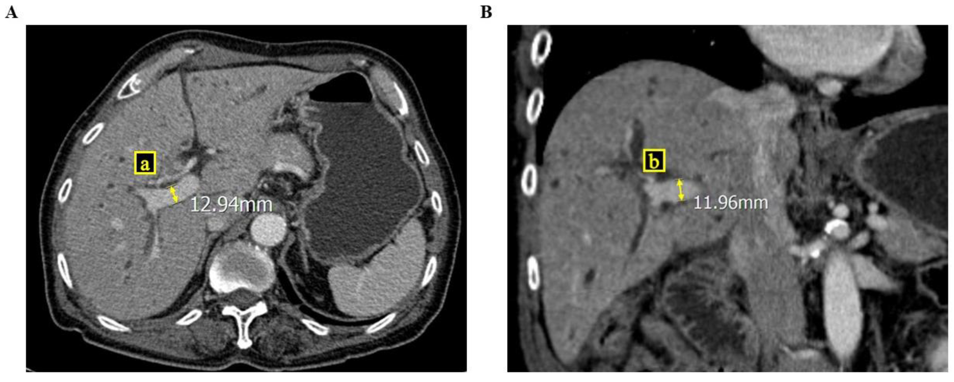 Medicina 60 01114 g001