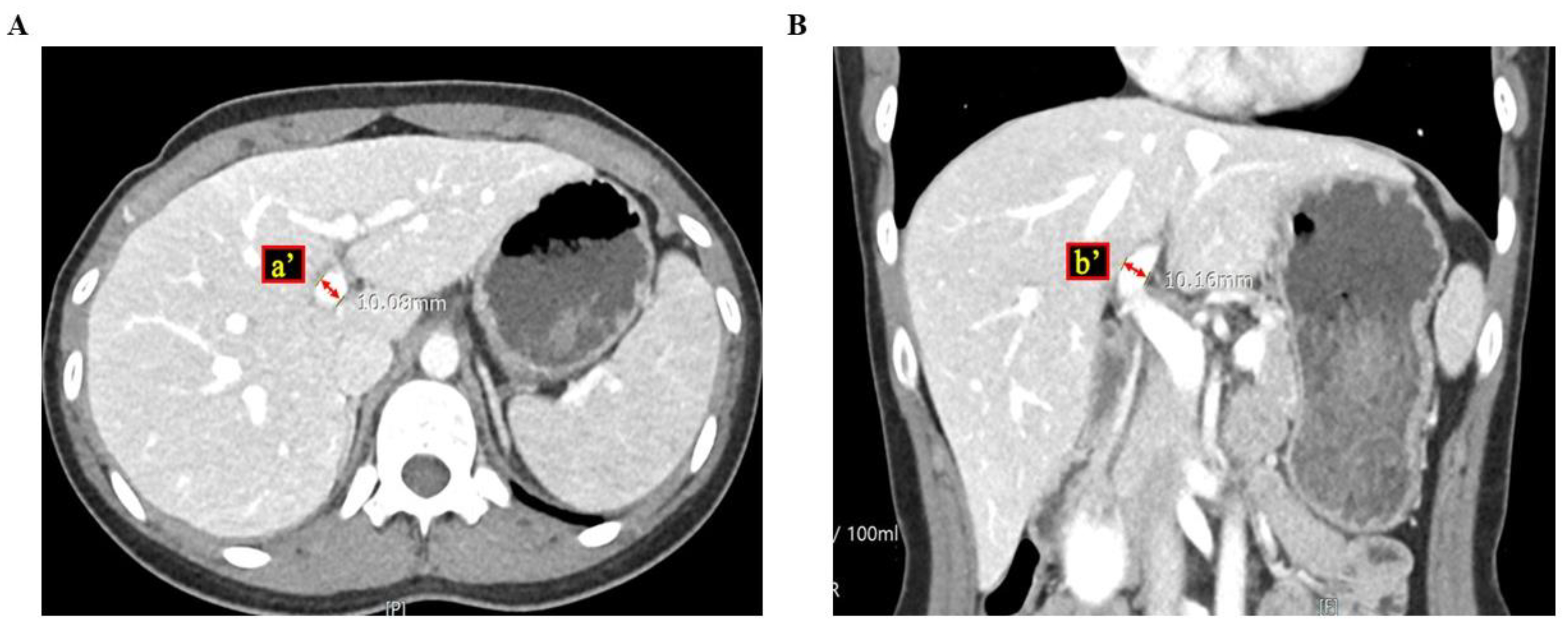 Medicina 60 01114 g002
