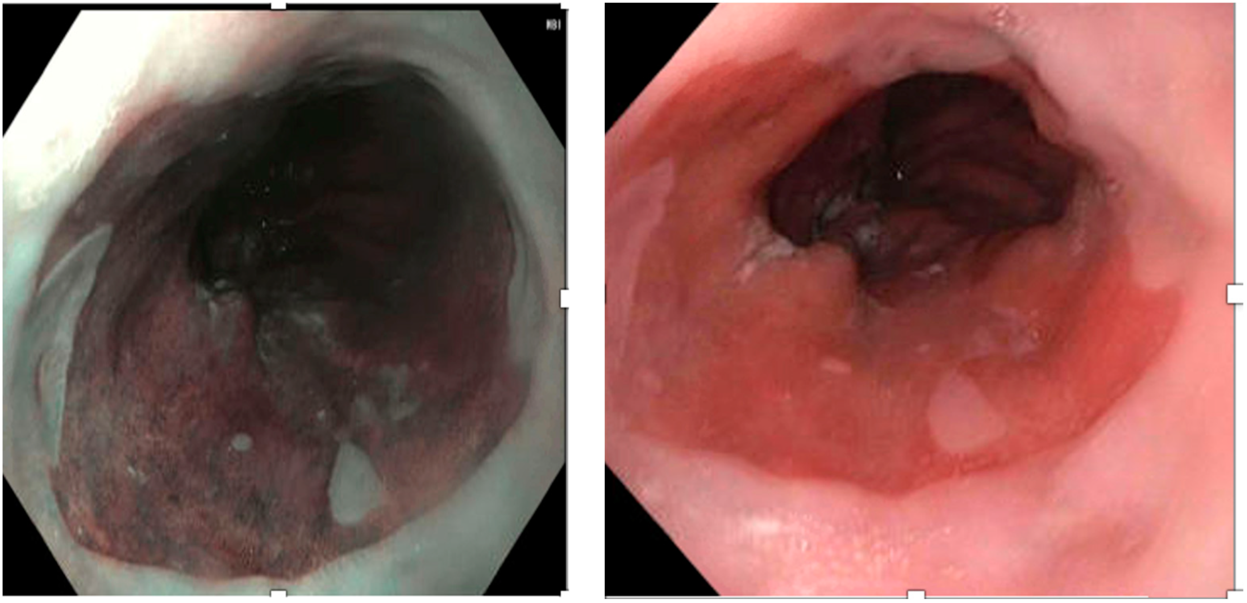 Medicina 60 01120 g003