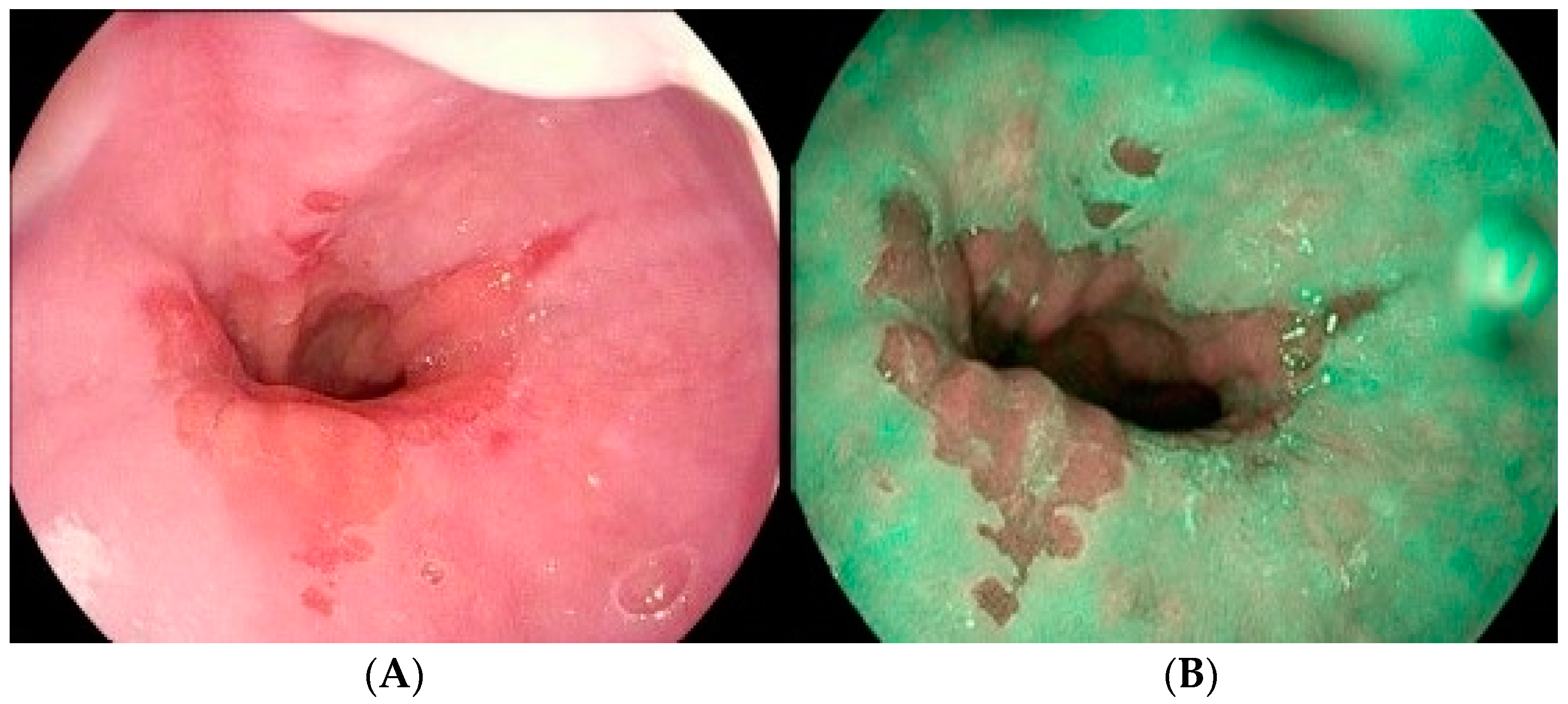 Medicina 60 01120 g004