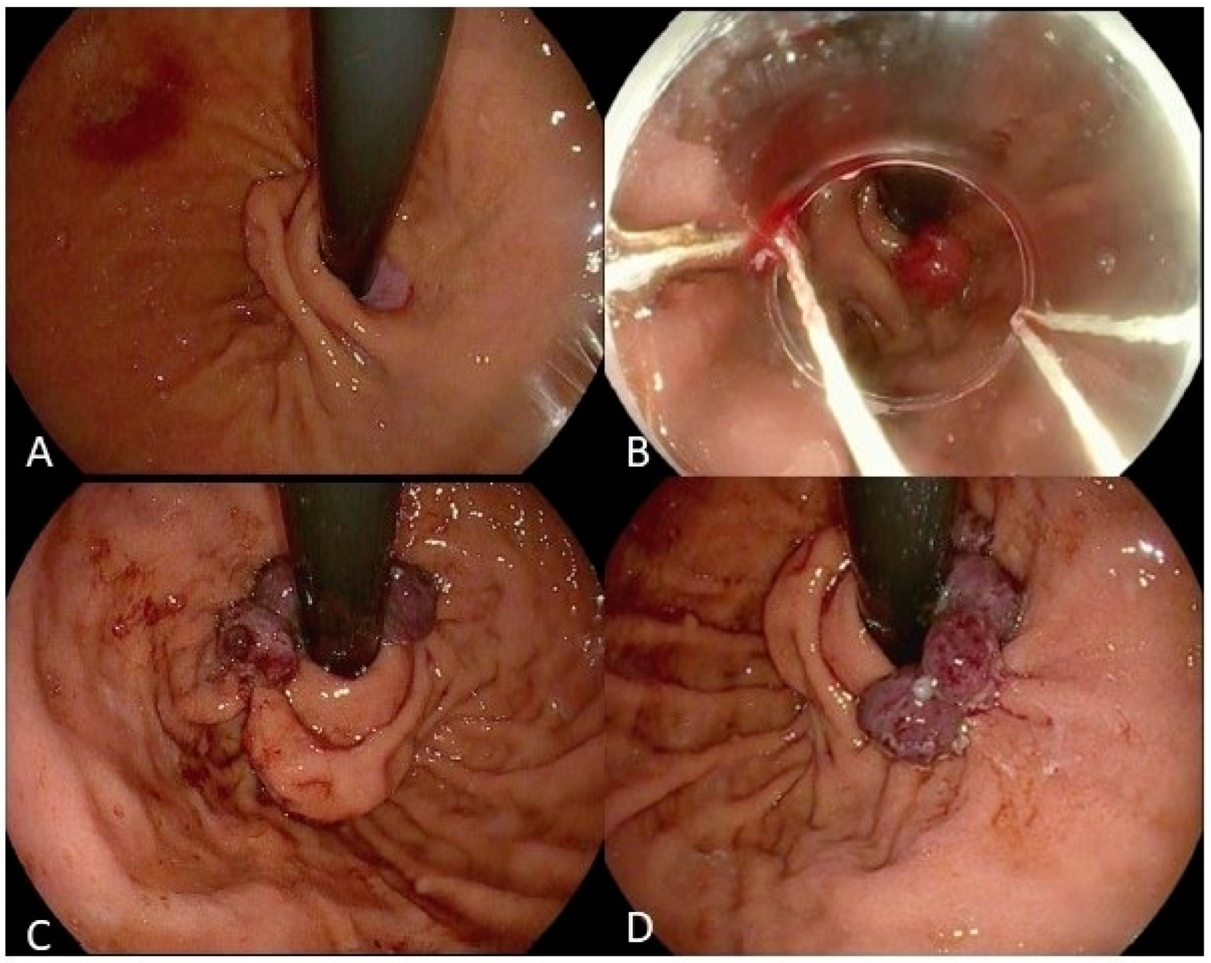 Medicina 60 01120 g006
