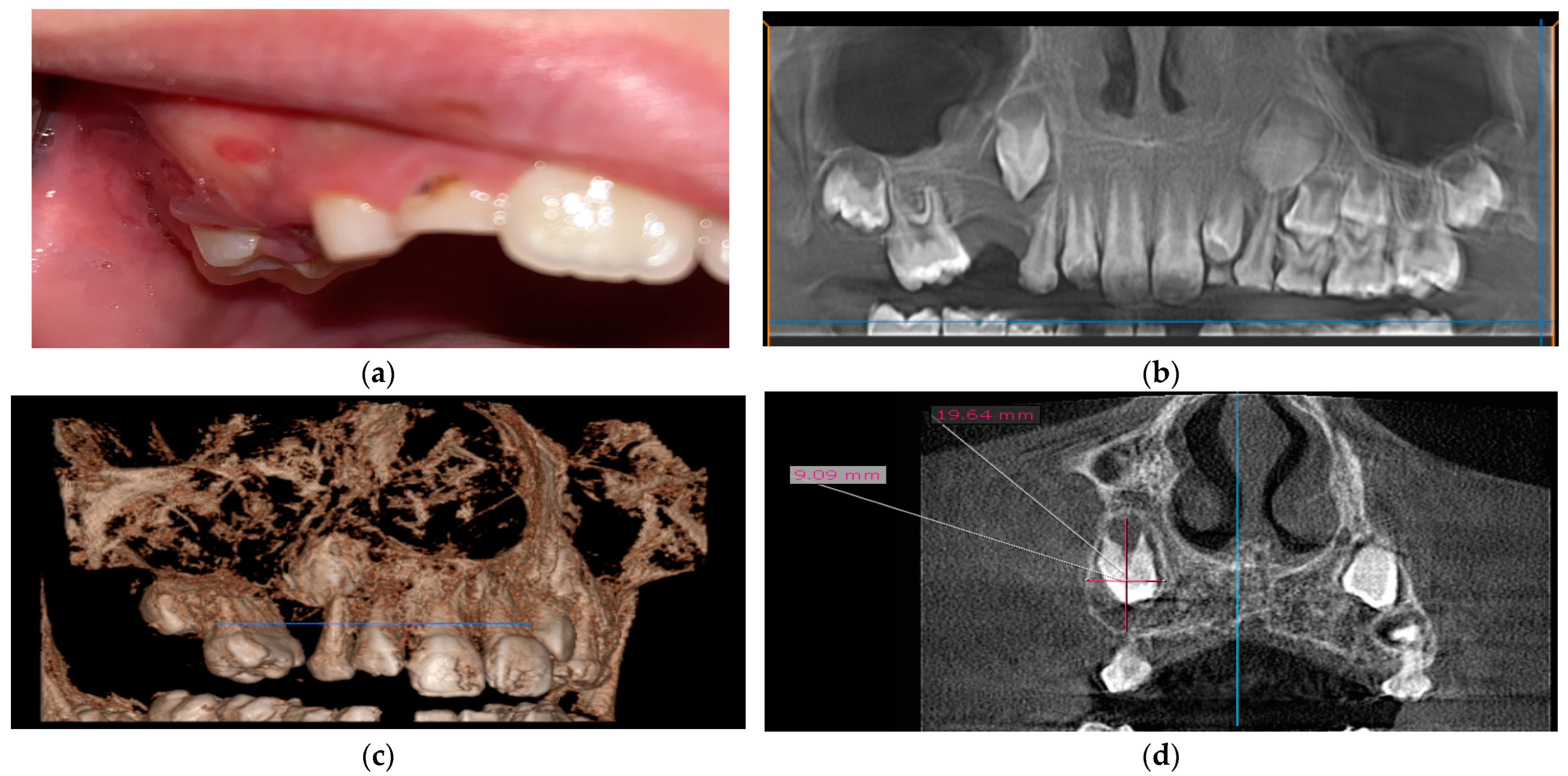 Medicina 60 01133 g001
