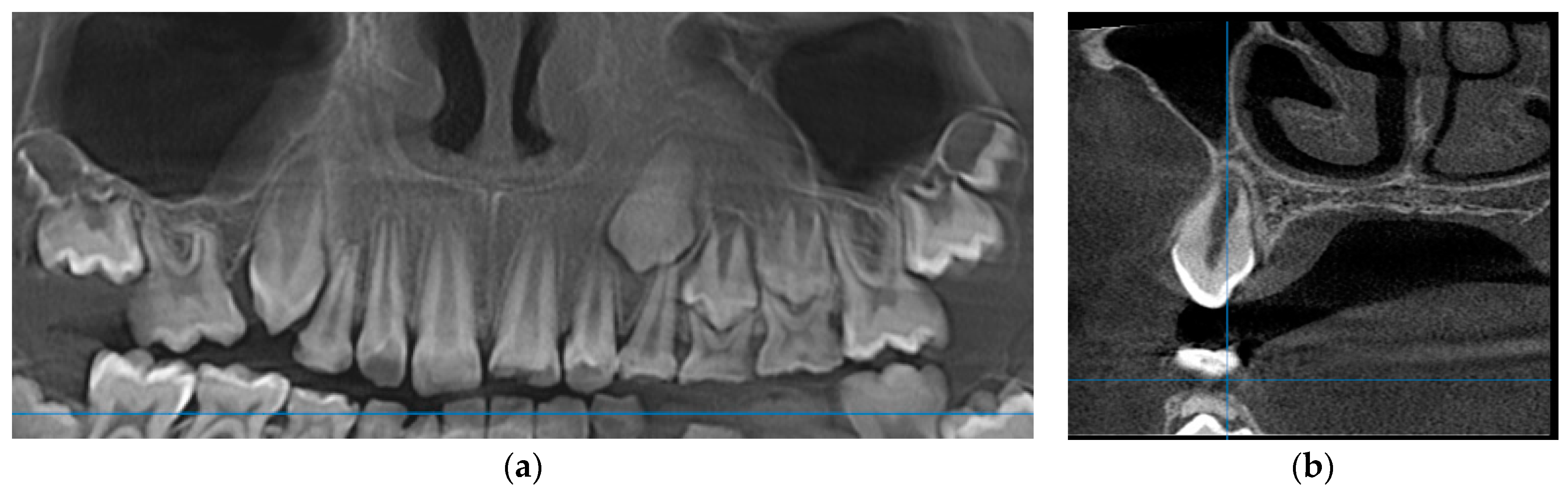 Medicina 60 01133 g002