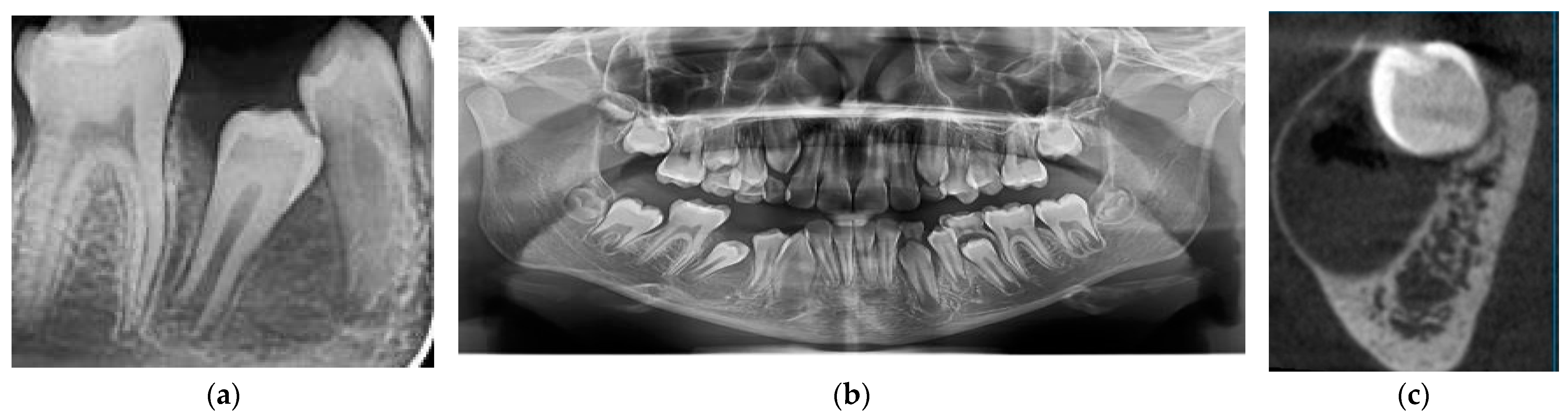 Medicina 60 01133 g003
