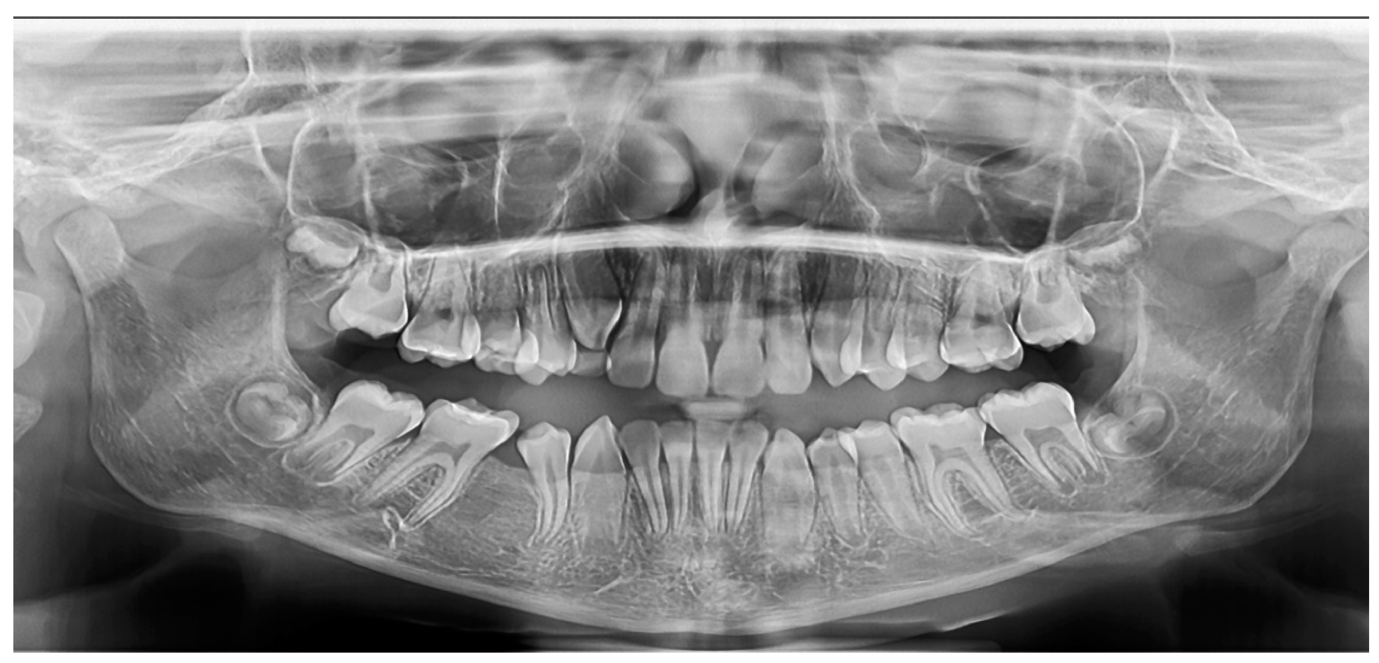 Medicina 60 01133 g004