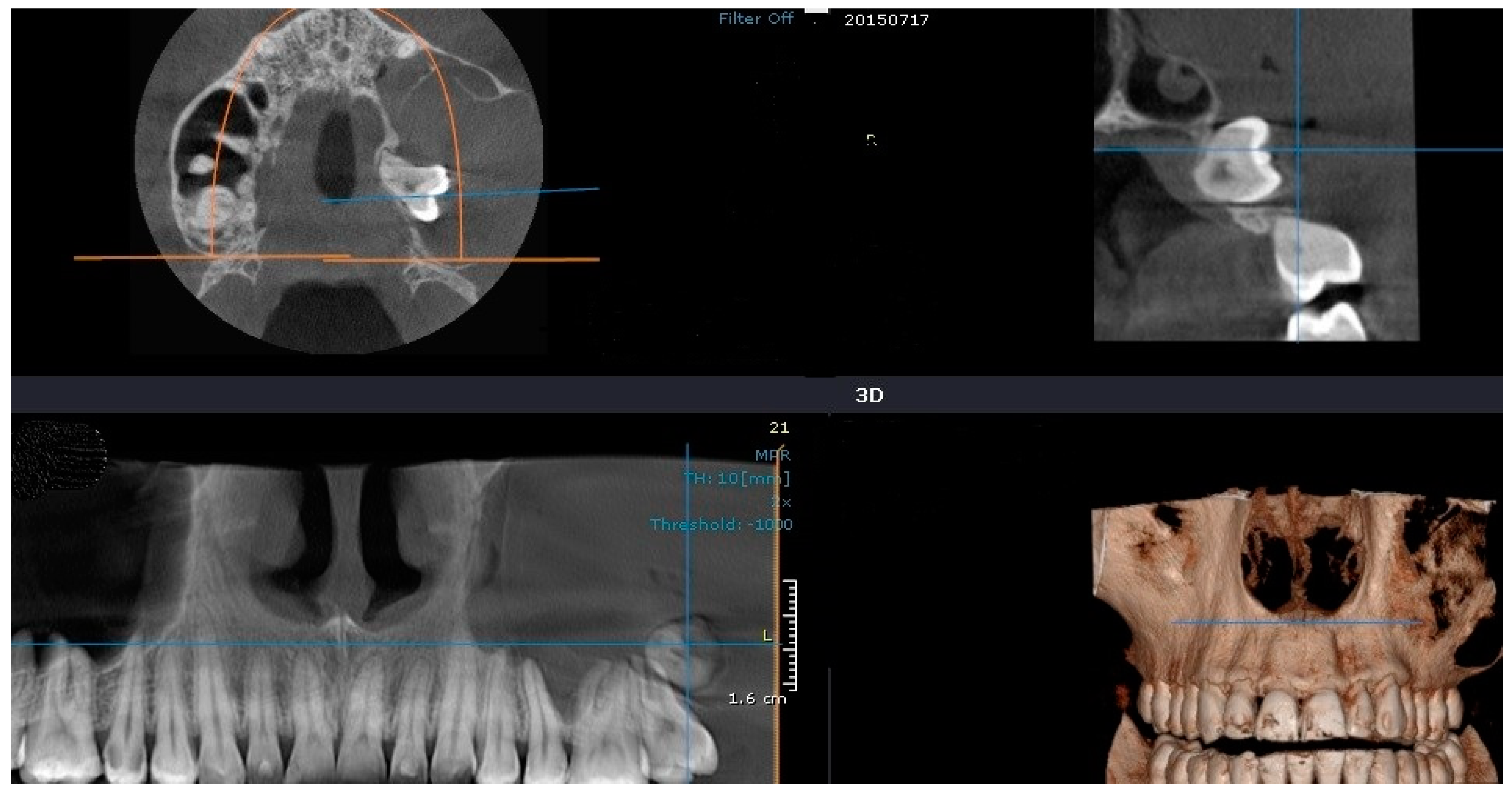 Medicina 60 01133 g005