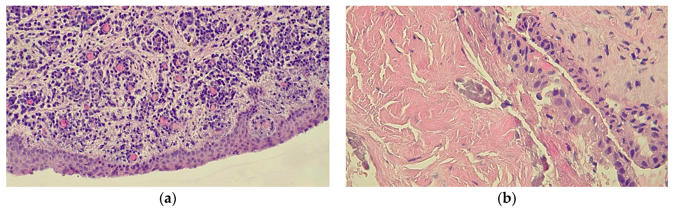 Medicina 60 01133 g007