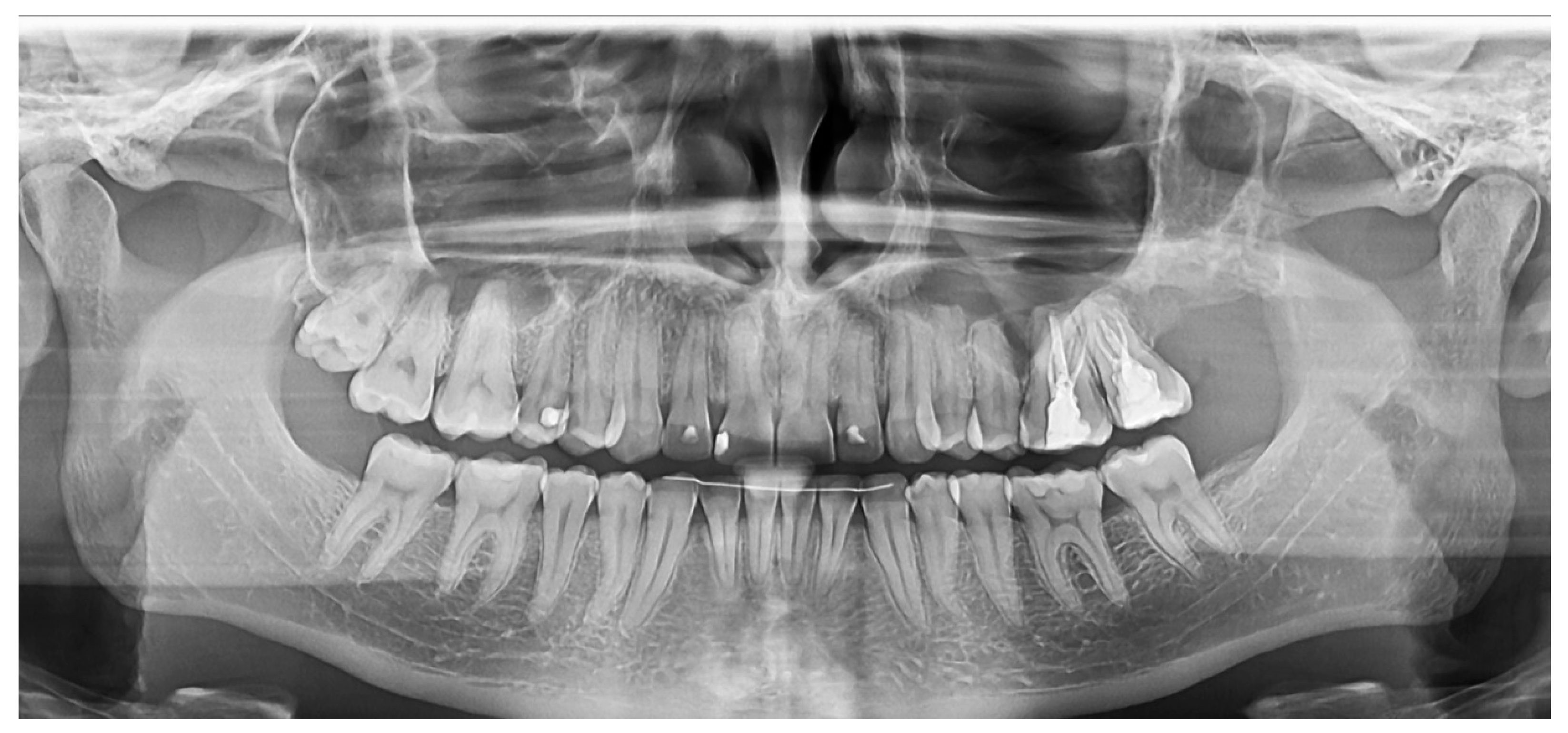 Medicina 60 01133 g008