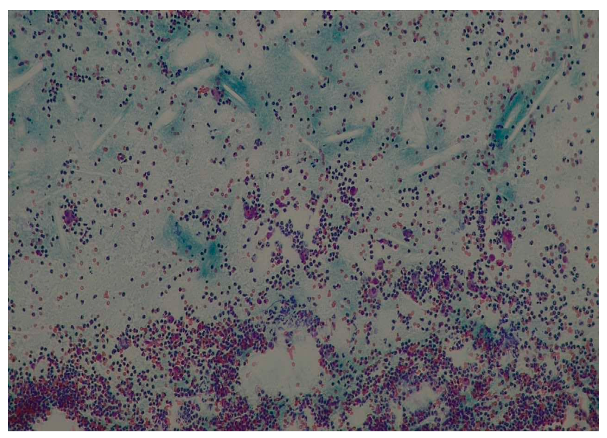 Medicina 60 01133 g010