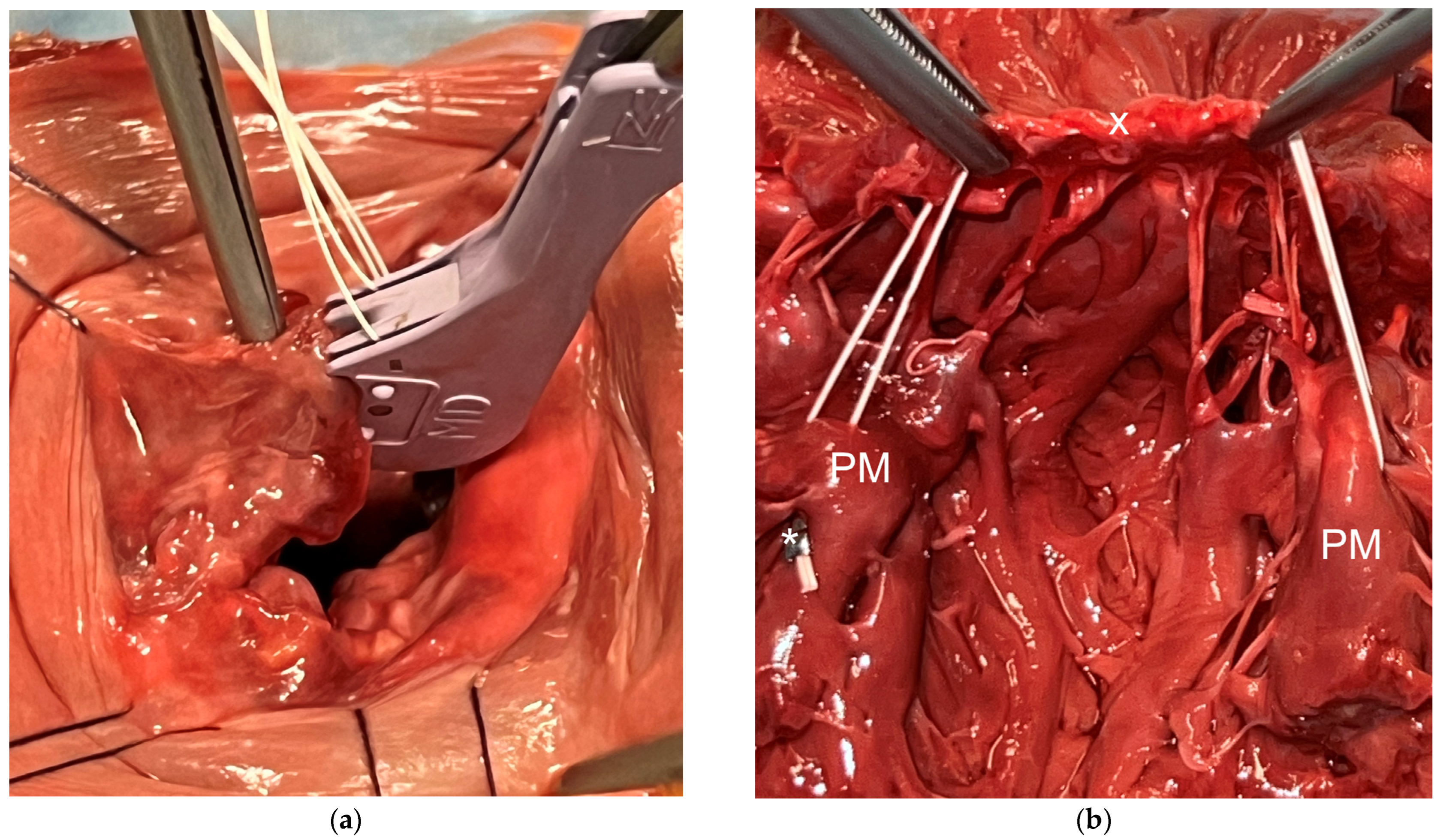 Medicina 60 01138 g001