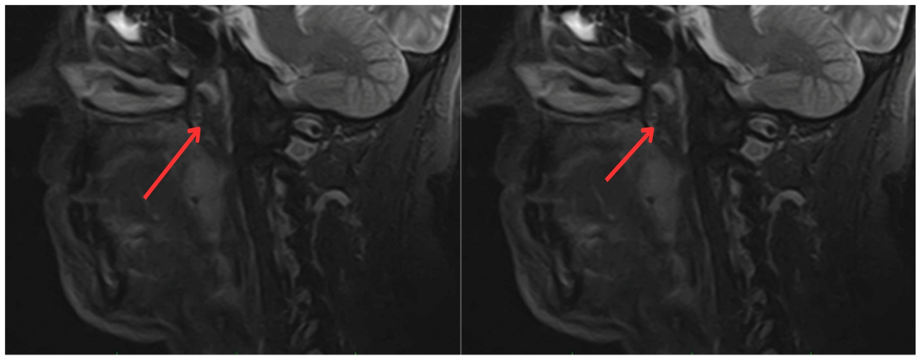 Medicina 60 01172 g003 Medicina 60 01172 g003