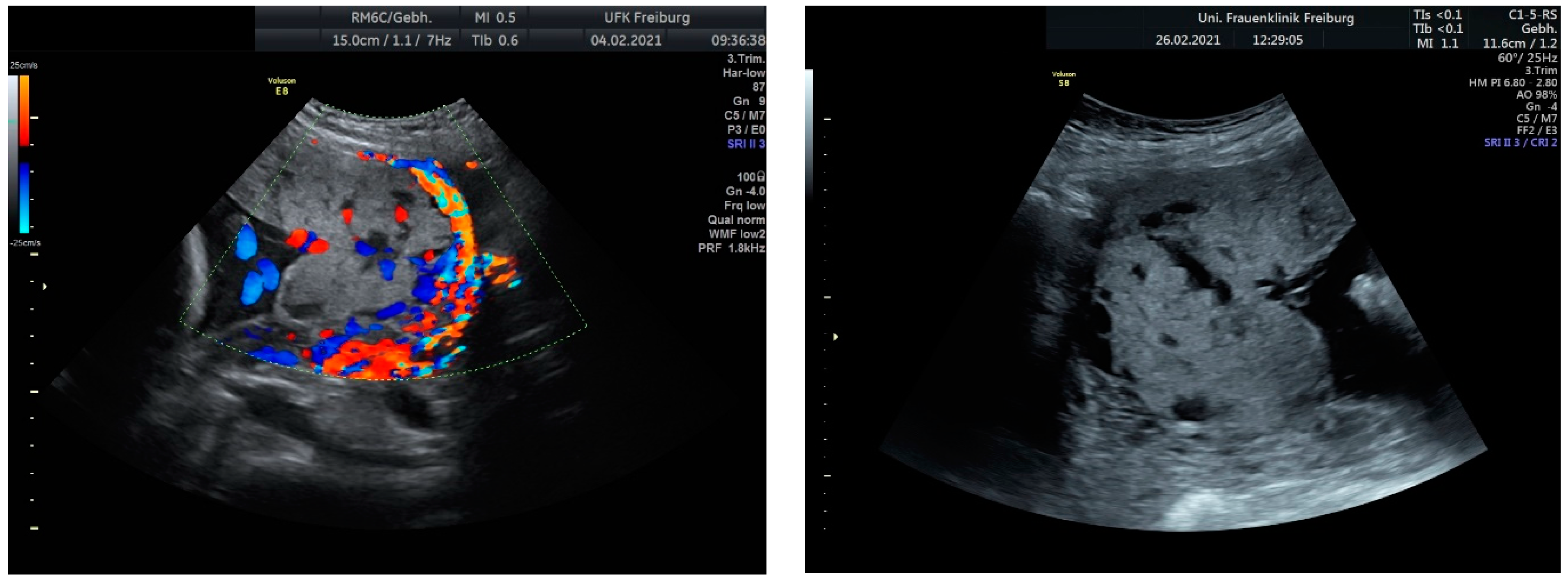 Medicina 60 01180 g002