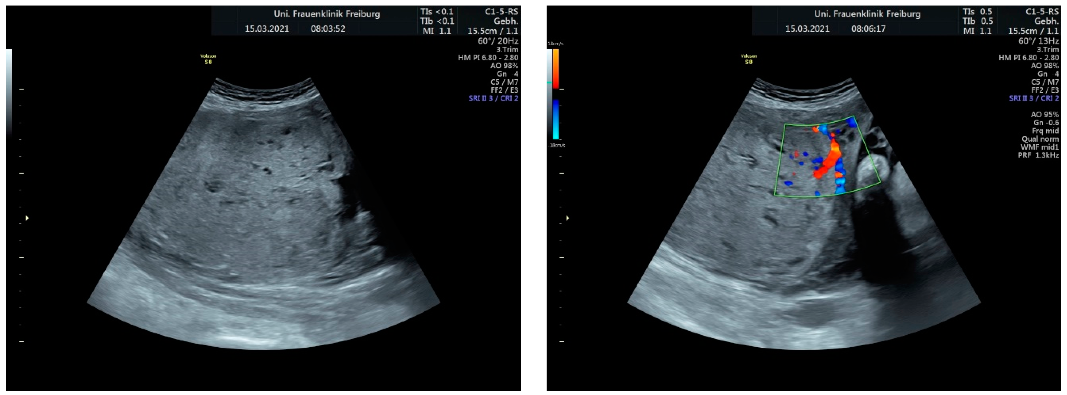 Medicina 60 01180 g004b