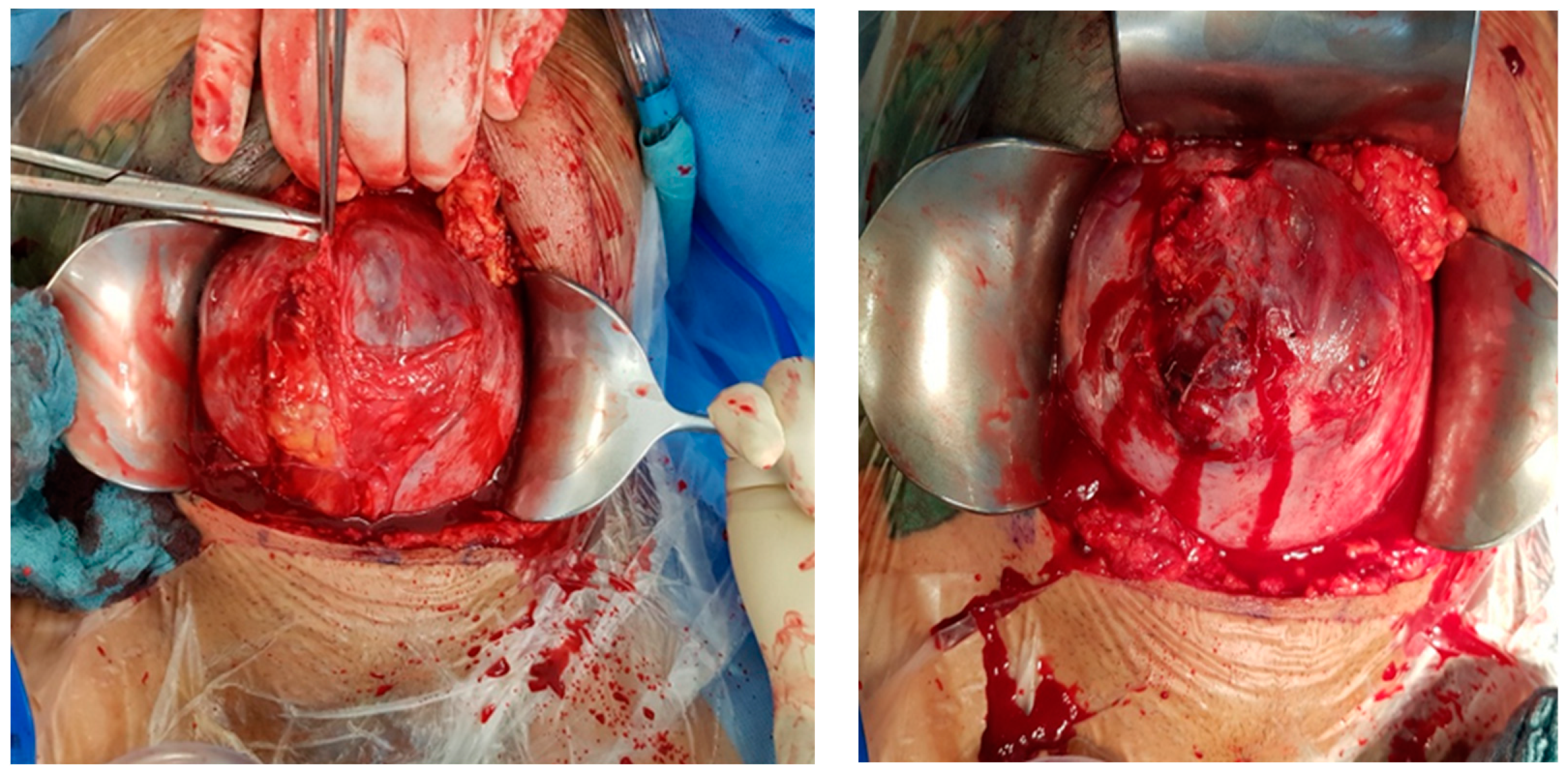 Medicina 60 01180 g005