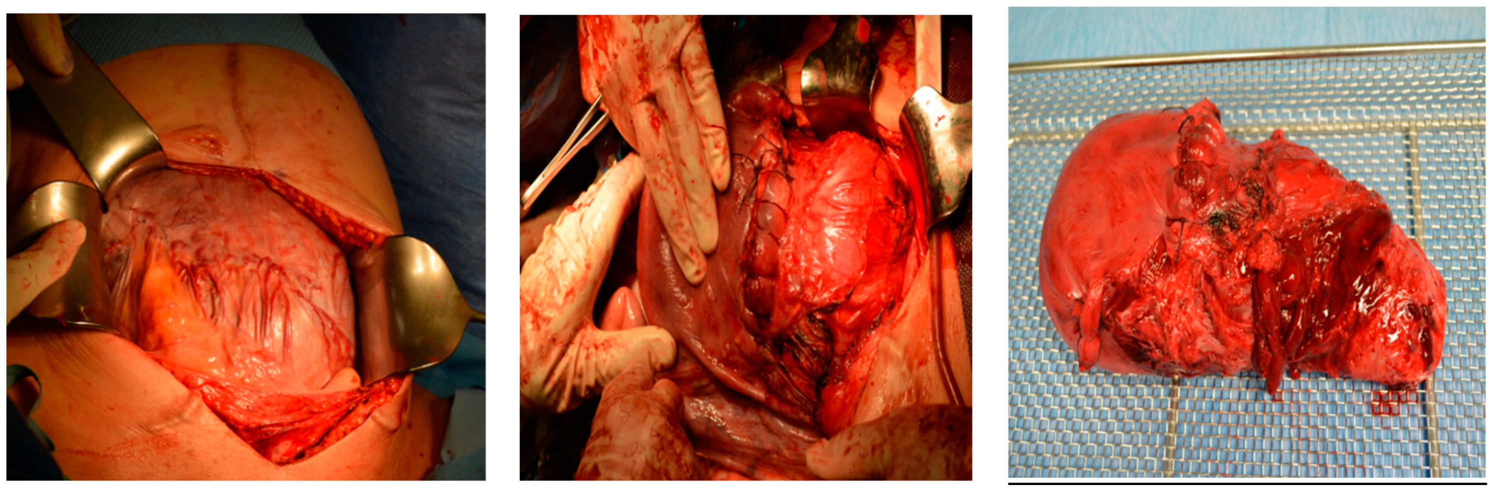 Medicina 60 01180 g008