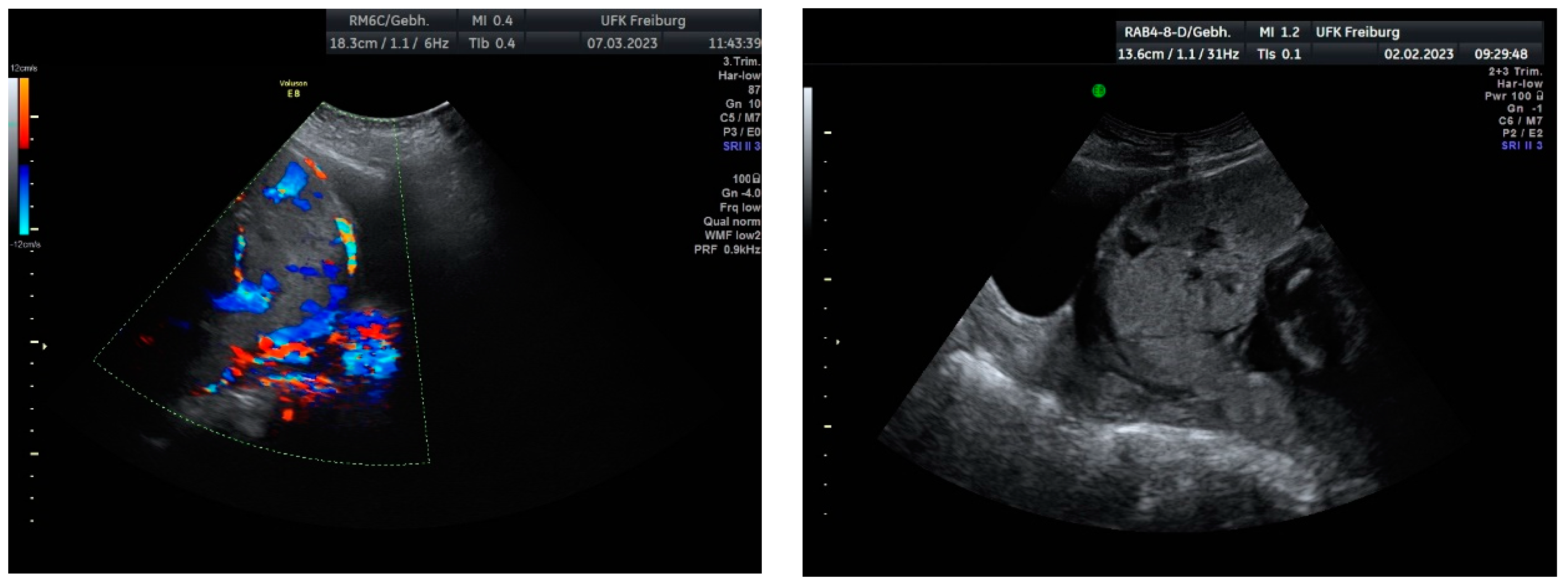 Medicina 60 01180 g009