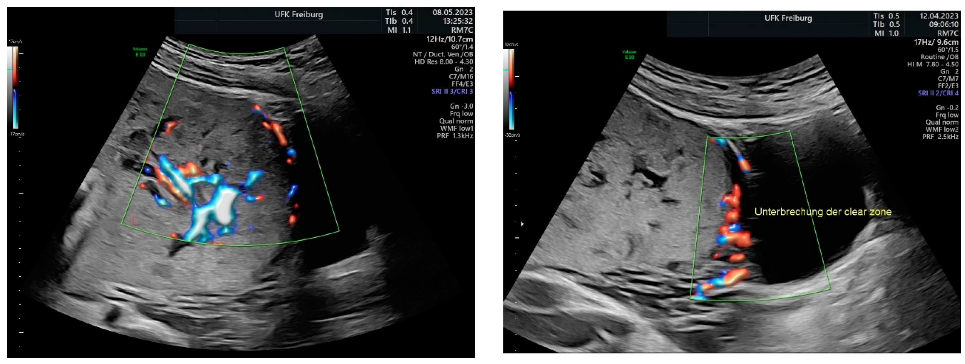 Medicina 60 01180 g012