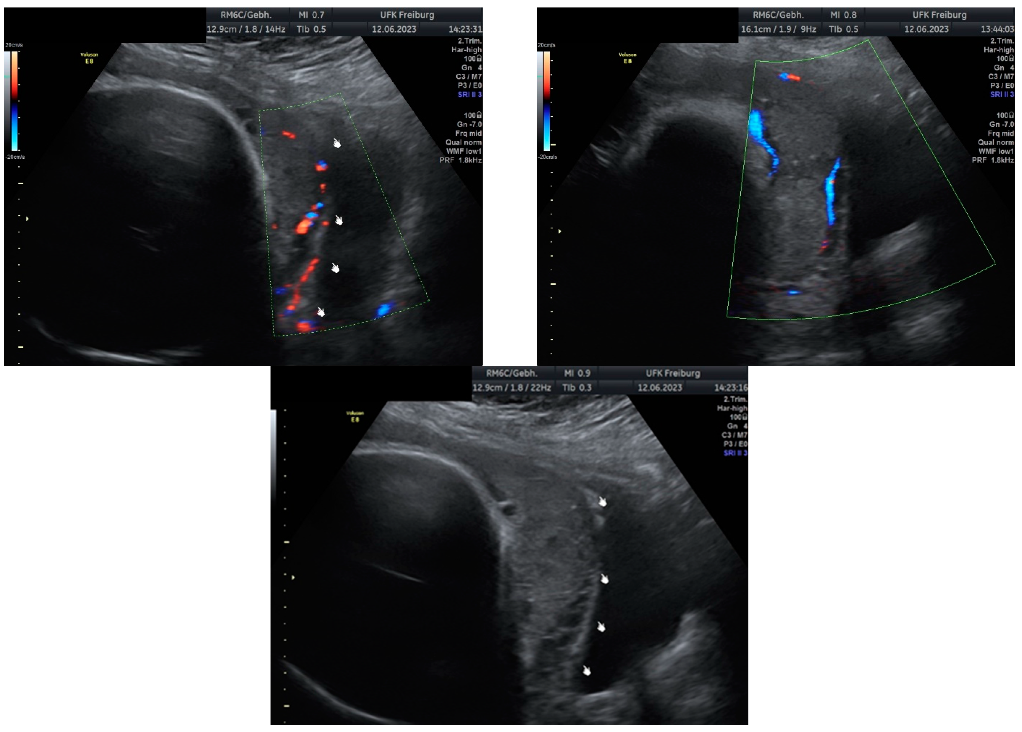 Medicina 60 01180 g013