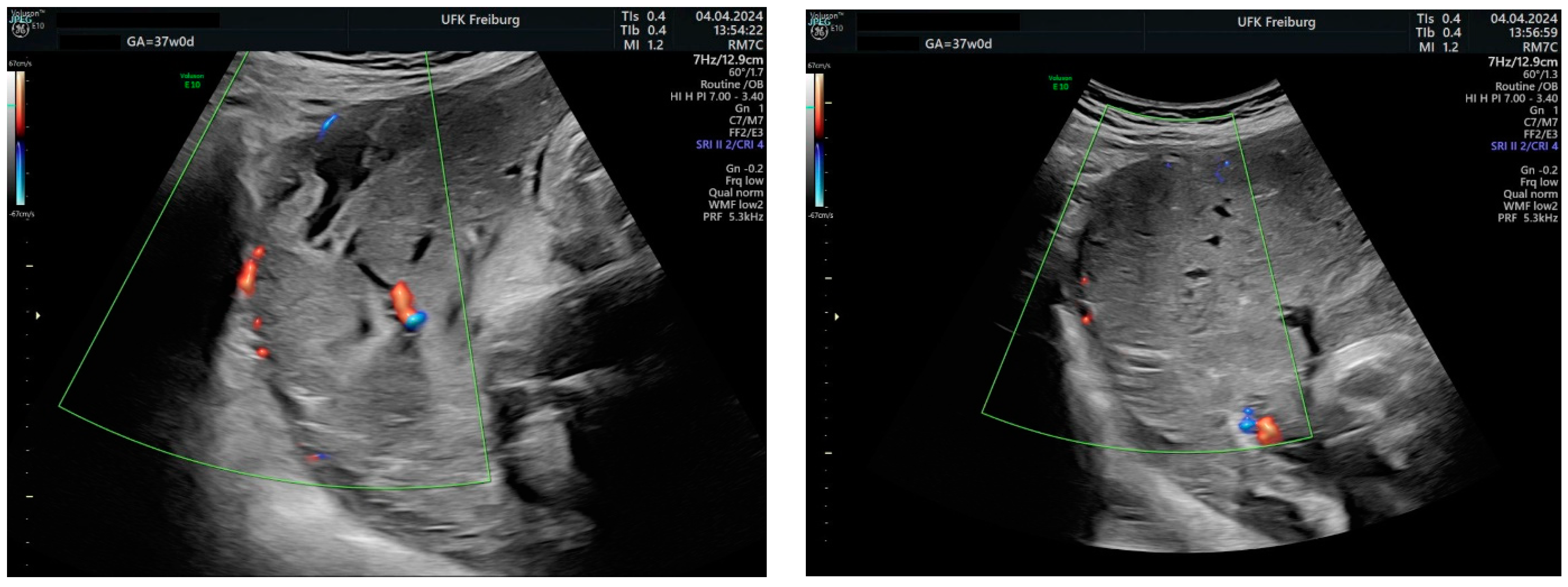 Medicina 60 01180 g014
