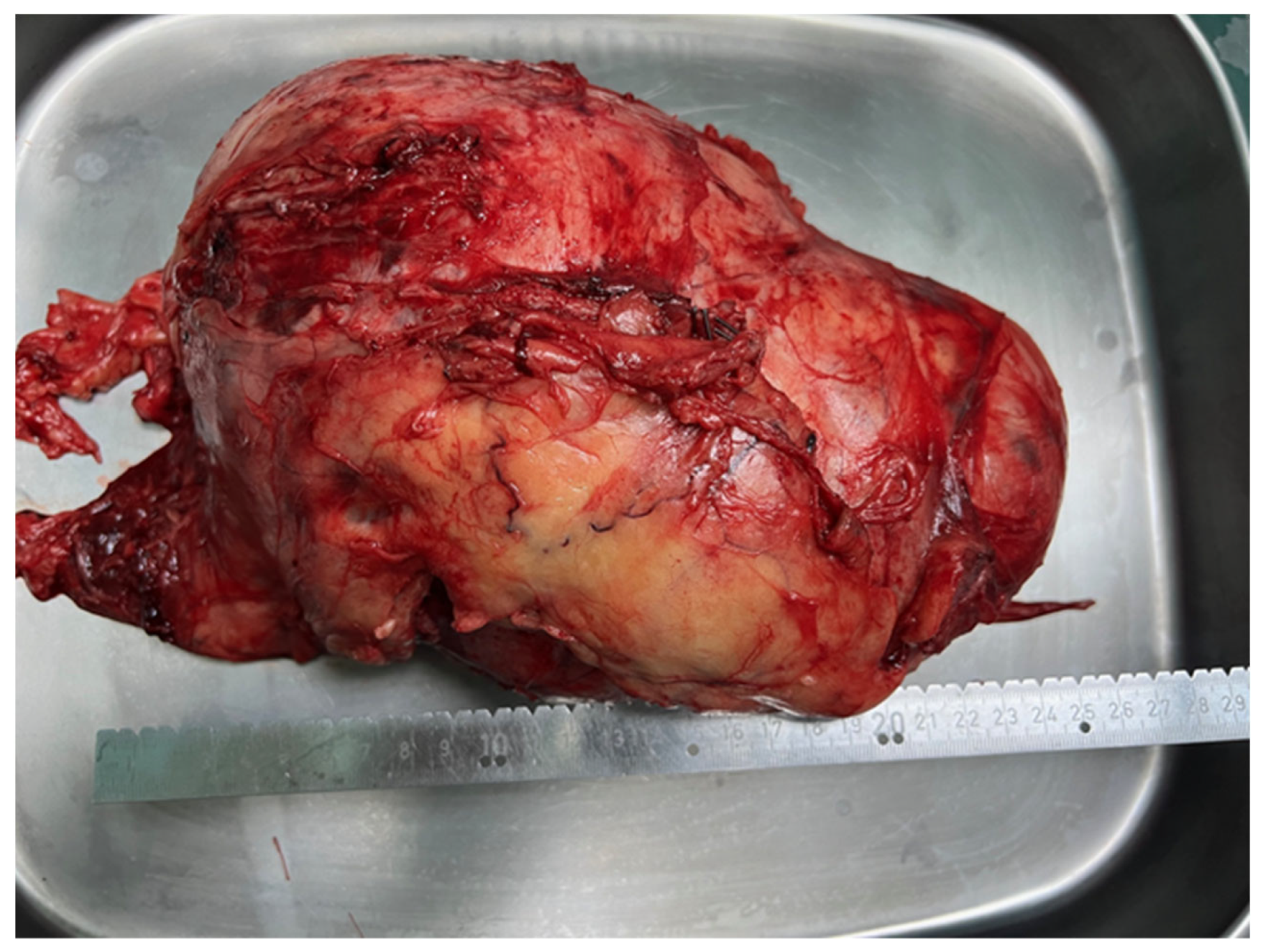 Medicina 60 01203 g003