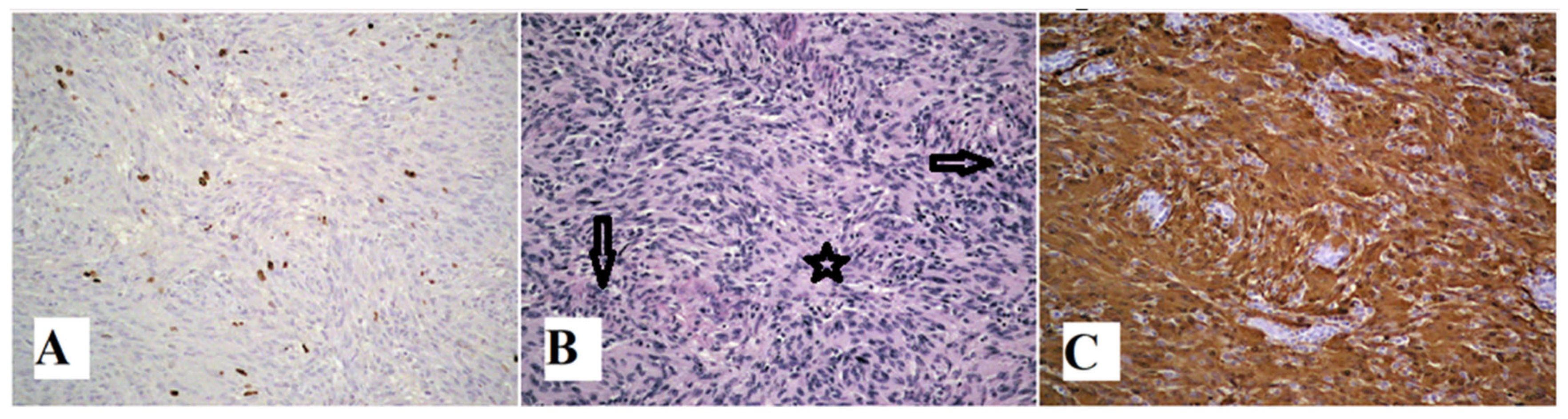Medicina 60 01203 g004