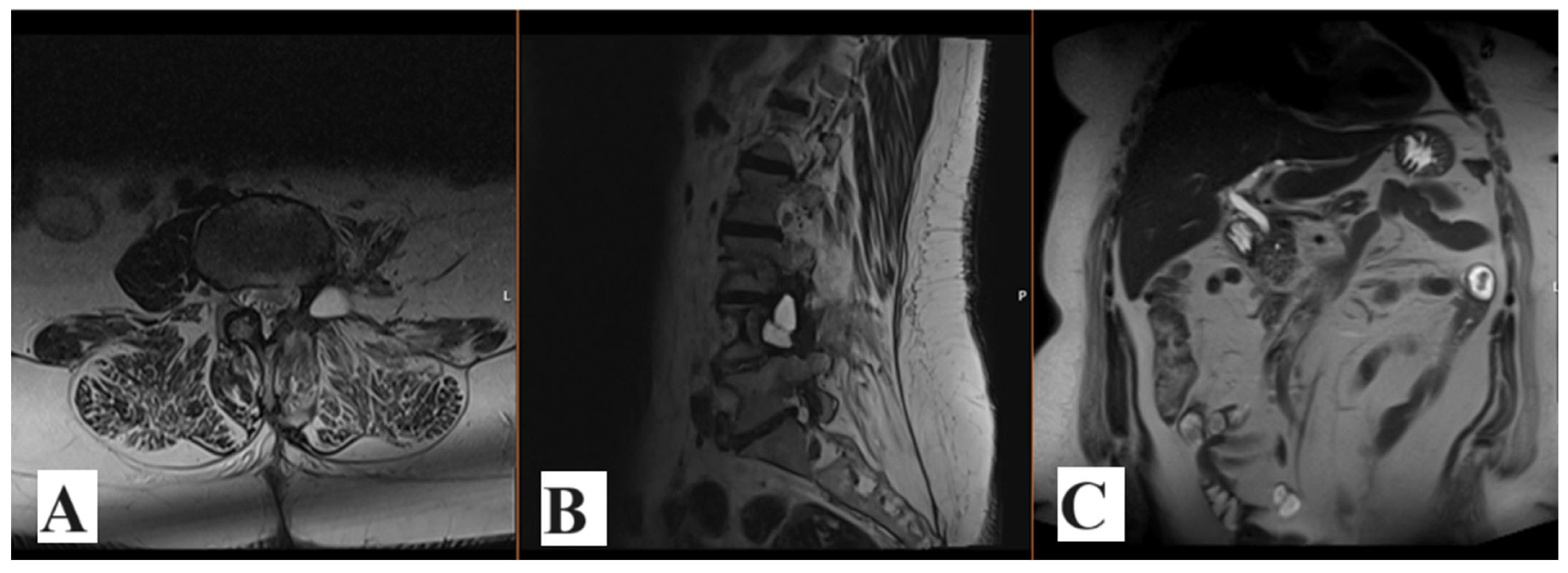 Medicina 60 01203 g005