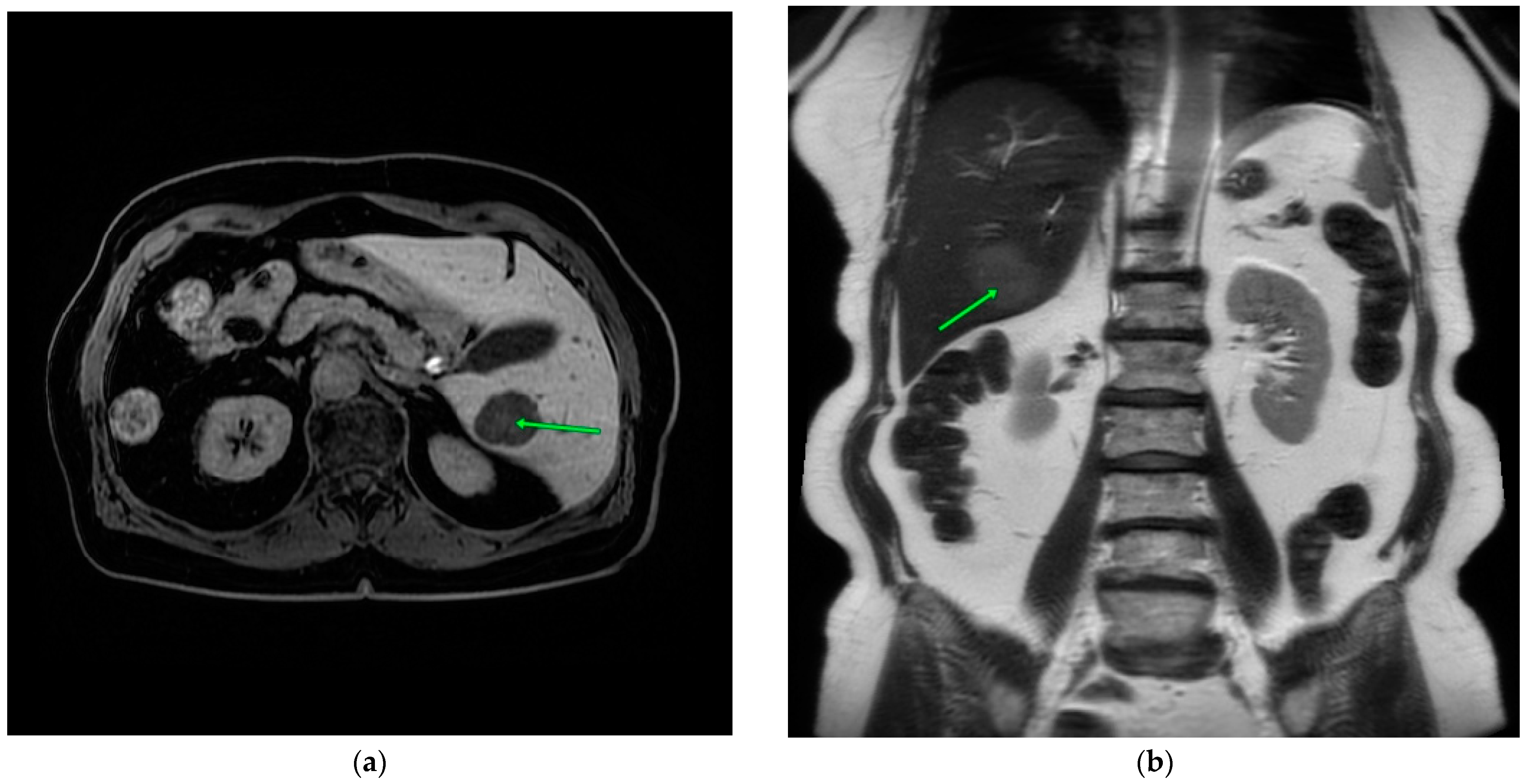 Medicina 60 01237 g002