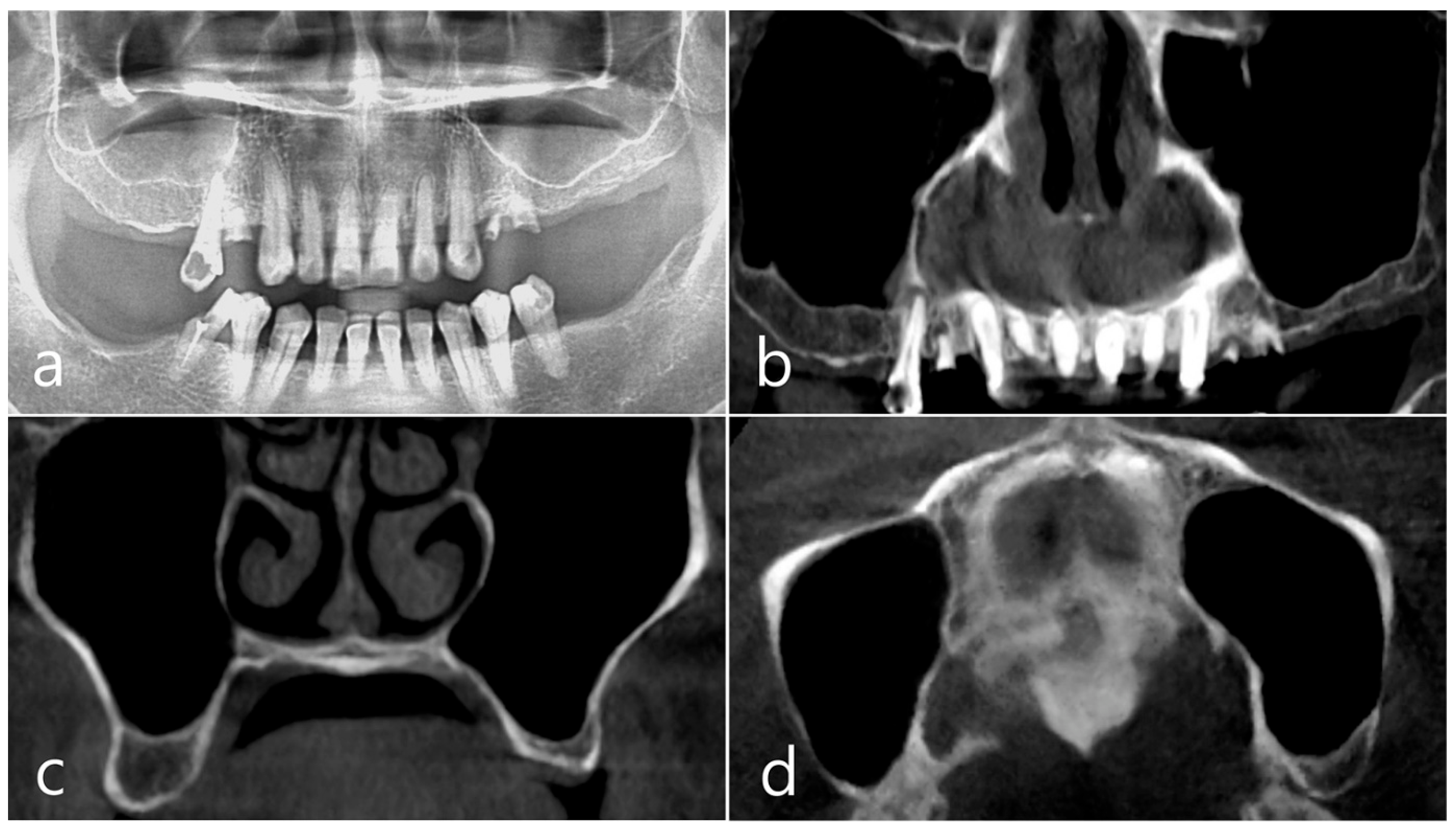 Medicina 60 01246 g001