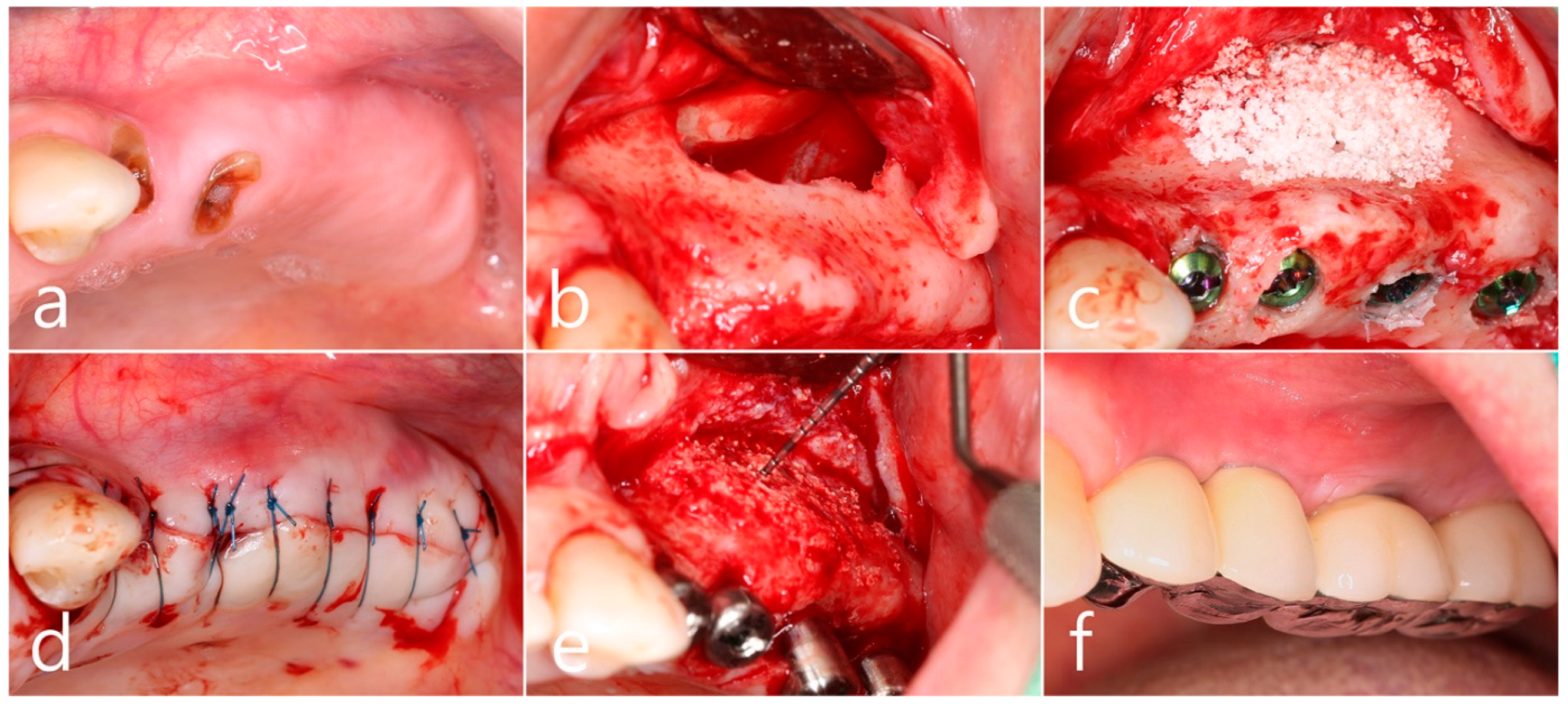 Medicina 60 01246 g002