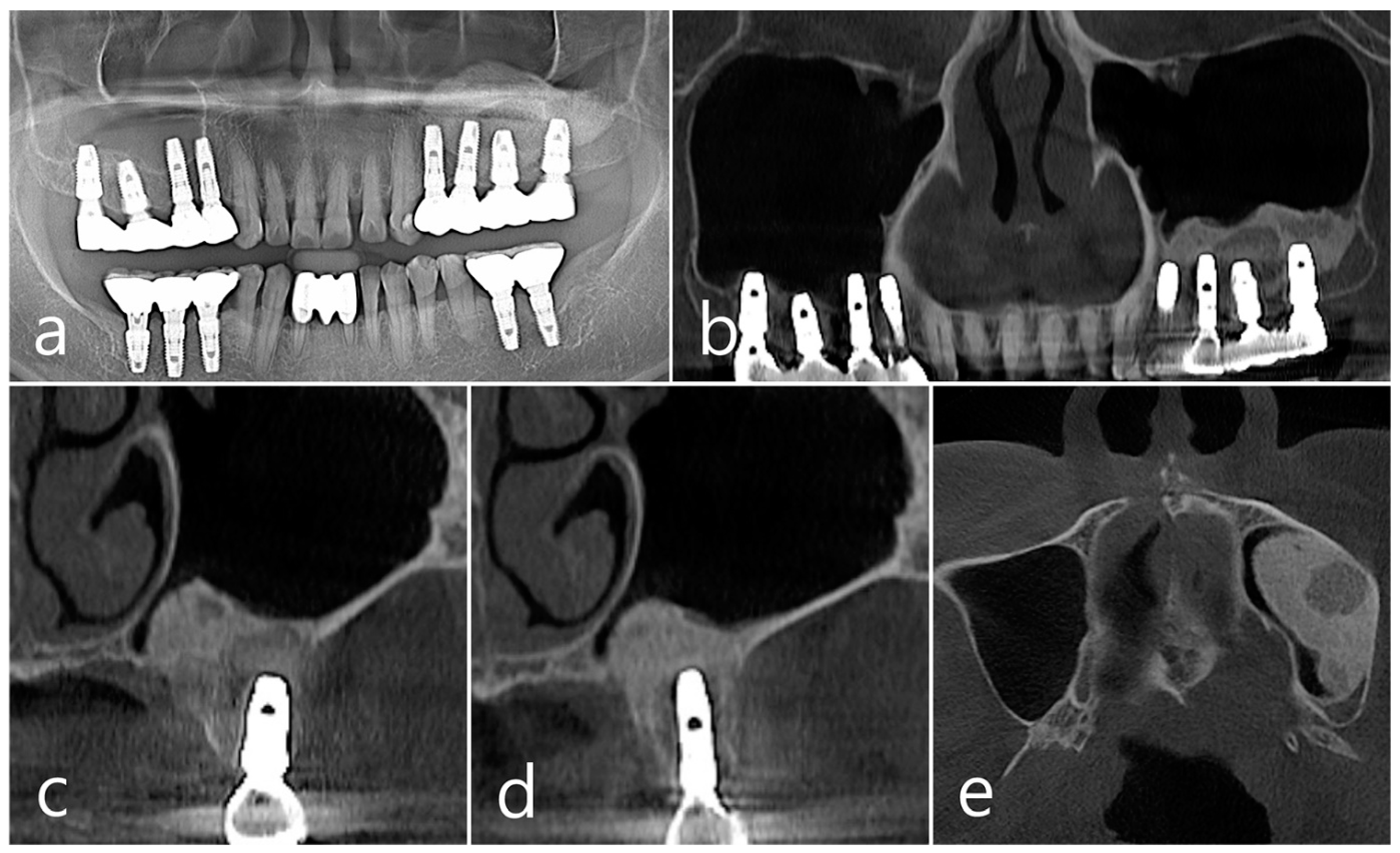 Medicina 60 01246 g004