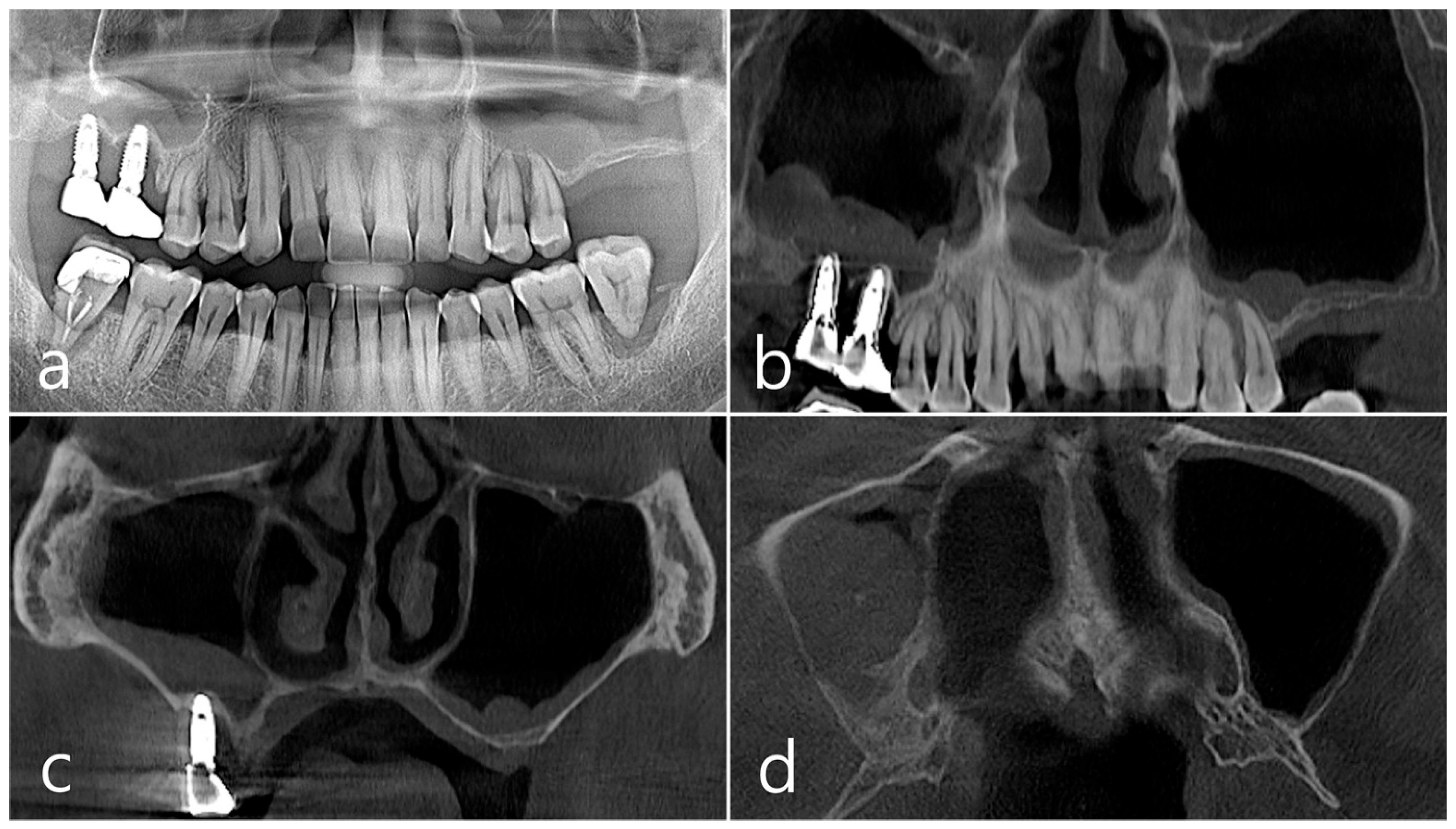 Medicina 60 01246 g007