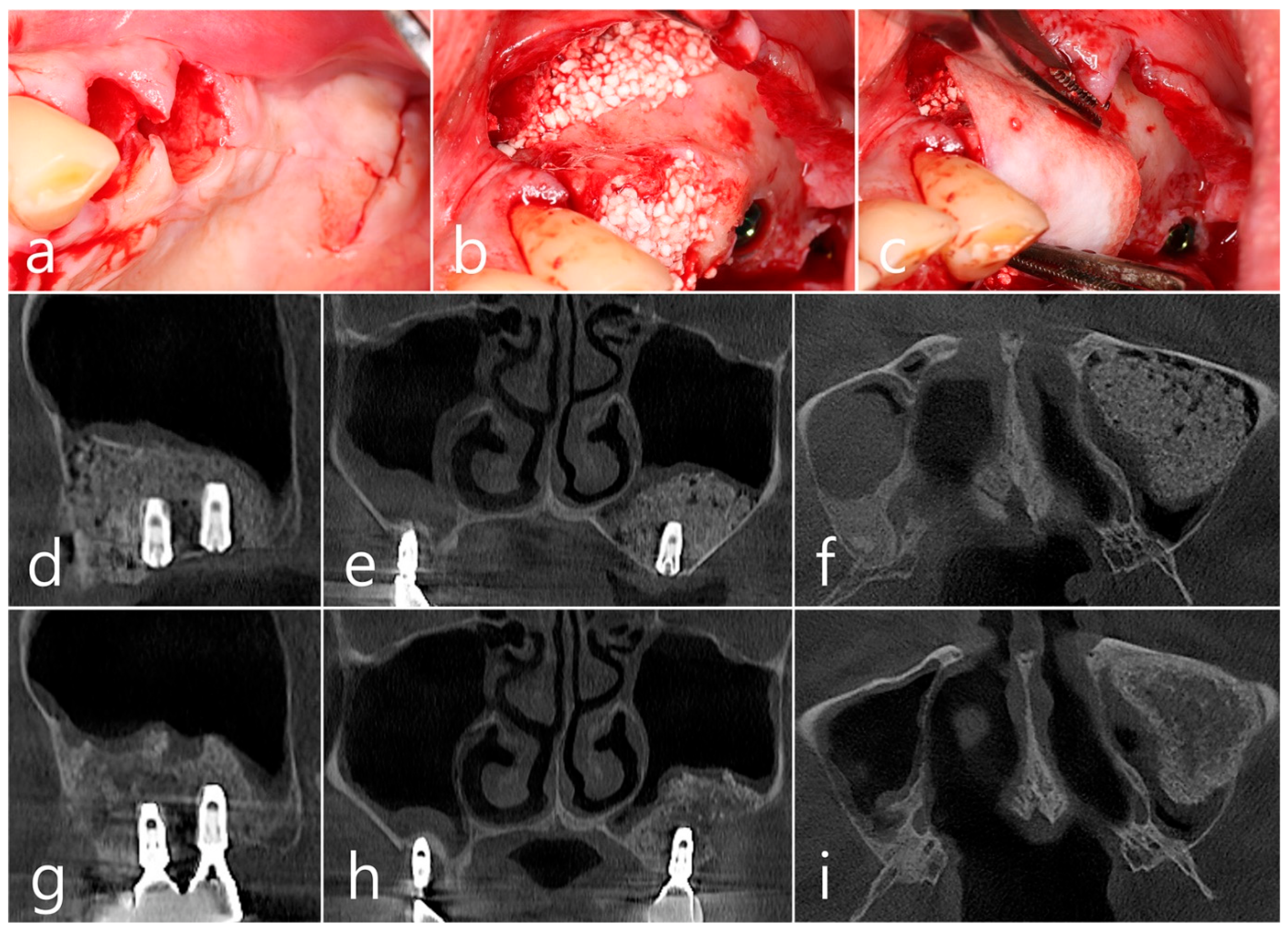 Medicina 60 01246 g008