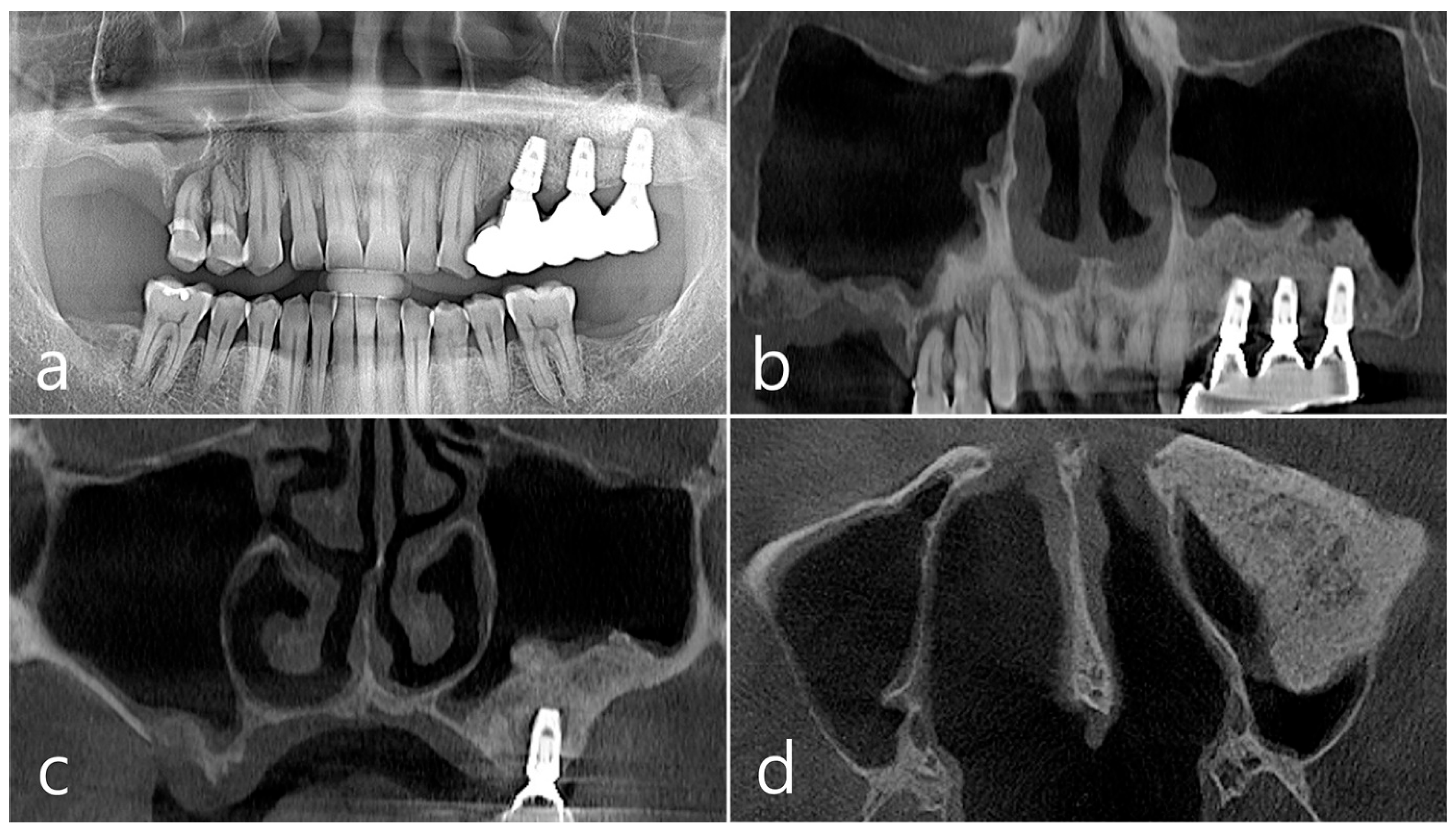Medicina 60 01246 g010