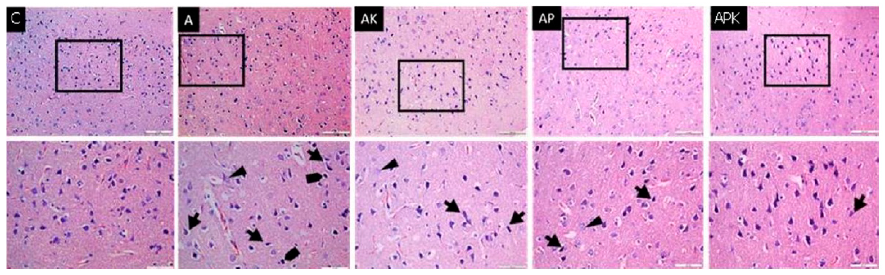 Medicina 60 01266 g001